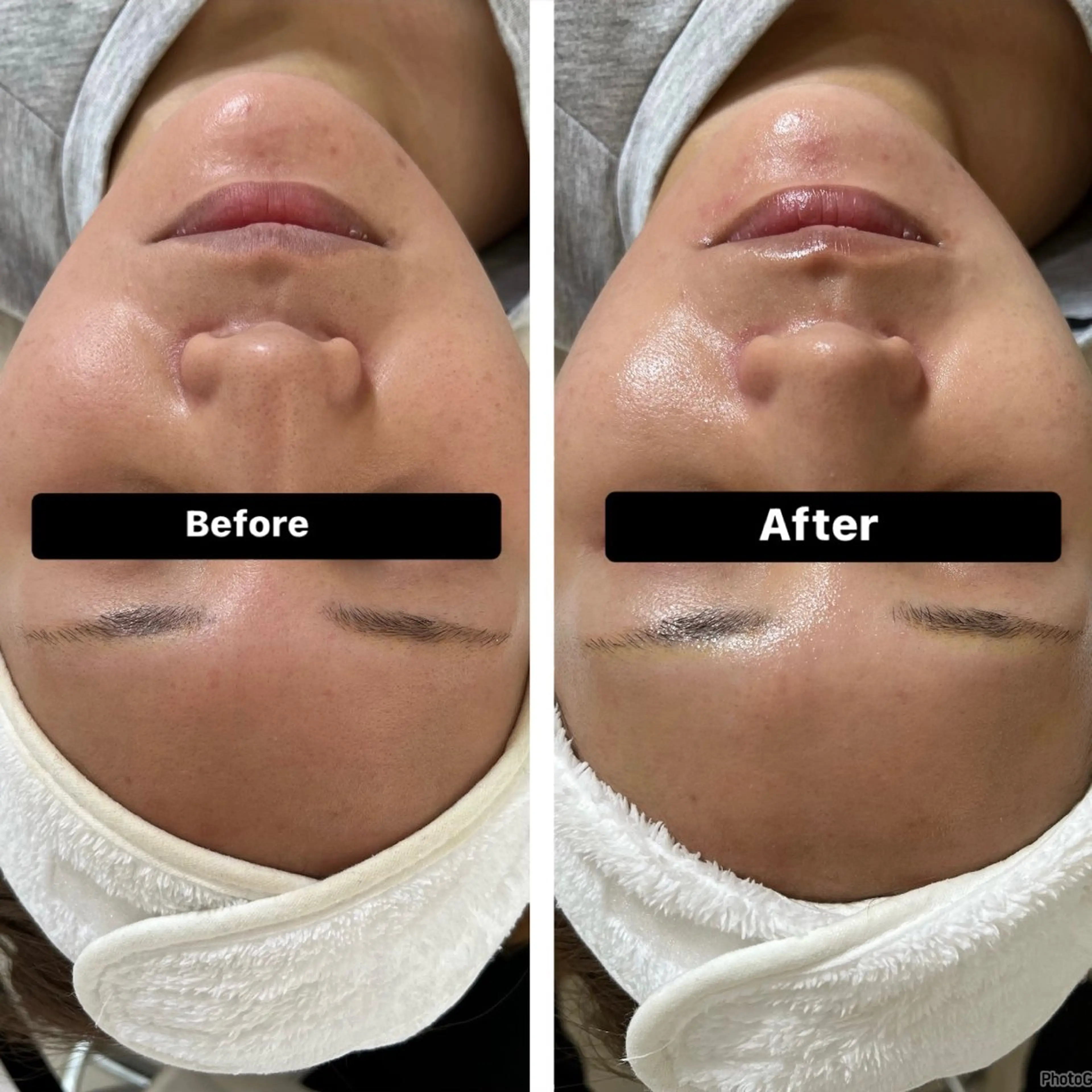 エステ 脱毛＆Beauty salon IILA所属・HBL💖 Sakuraの眉毛・アイブロウイメージ