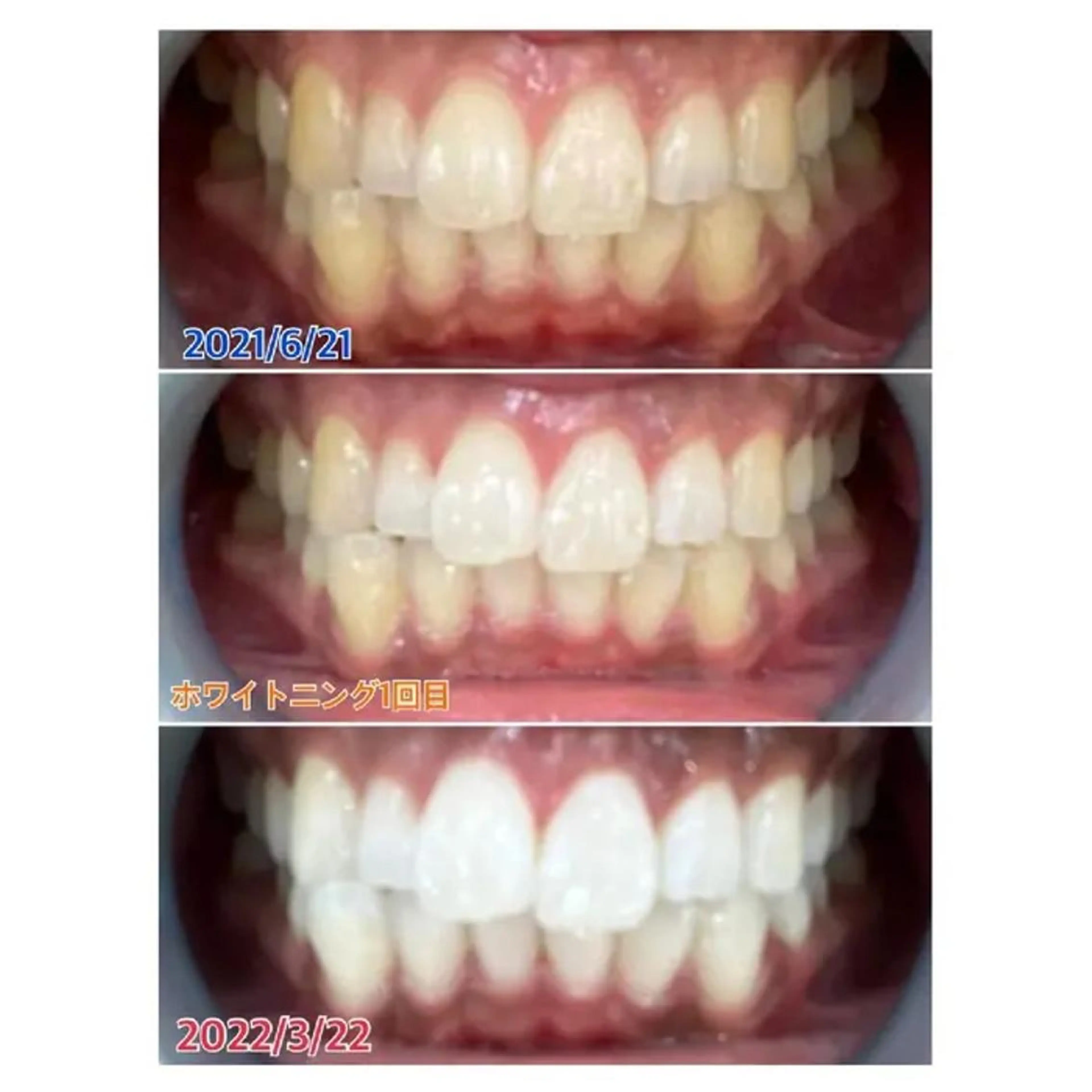 Ｍ渋谷 ホワイトニングのエステ・リラクイメージ