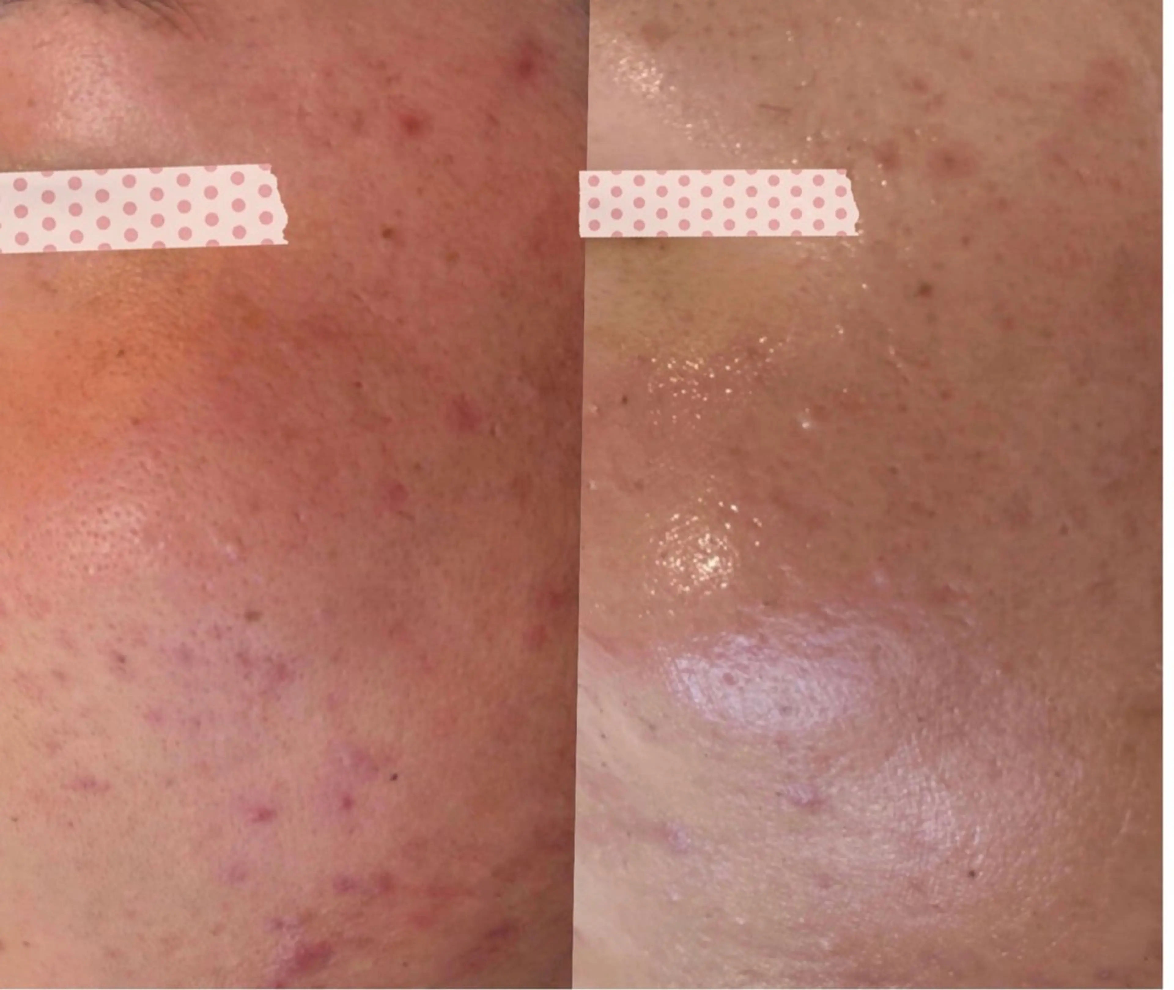 mimiBrun 肌質改善/脚浮腫みのエステ・リラクイメージ