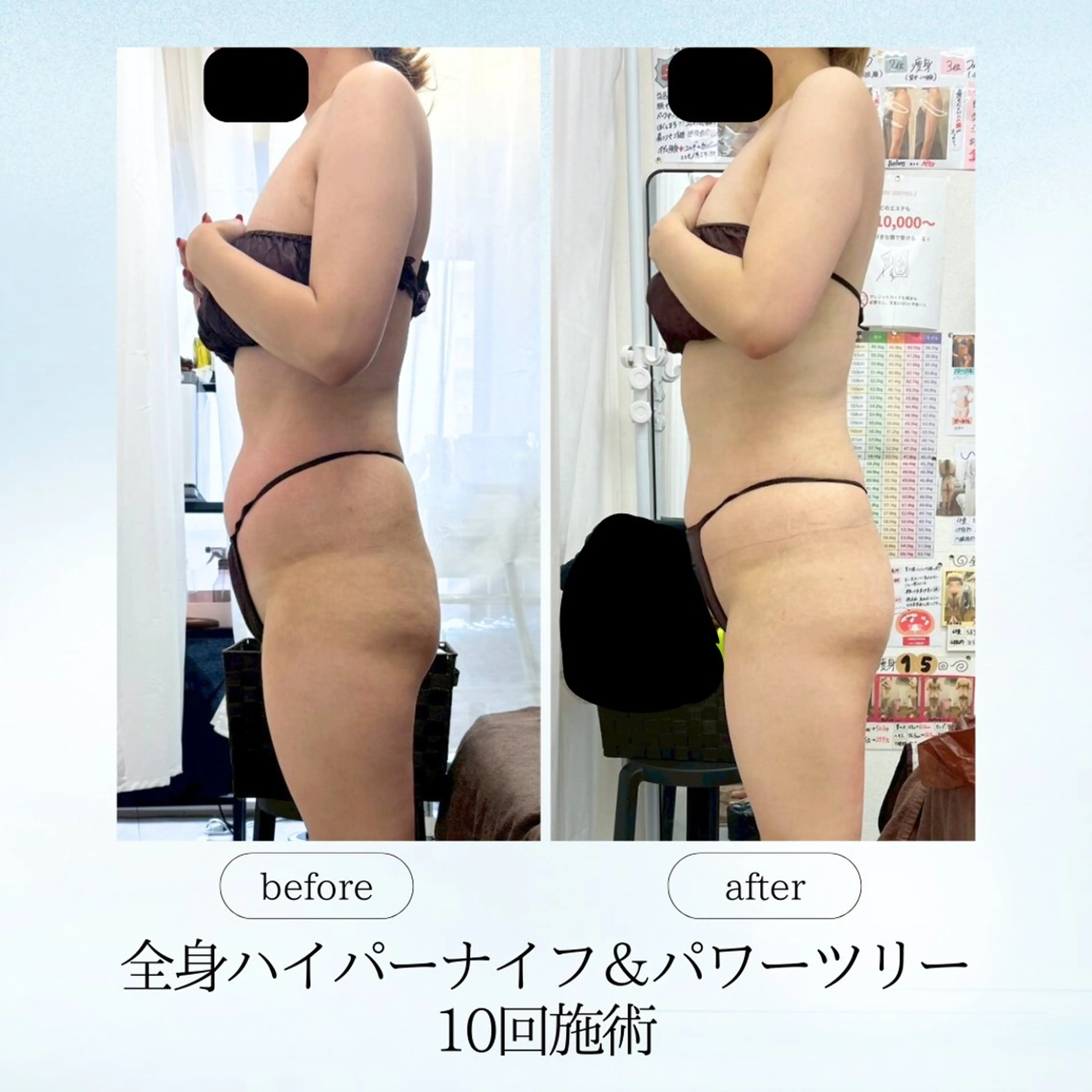 エステ リラク 《痩身、小顔専門店》 エスプレッソのエステ・リラクイメージ