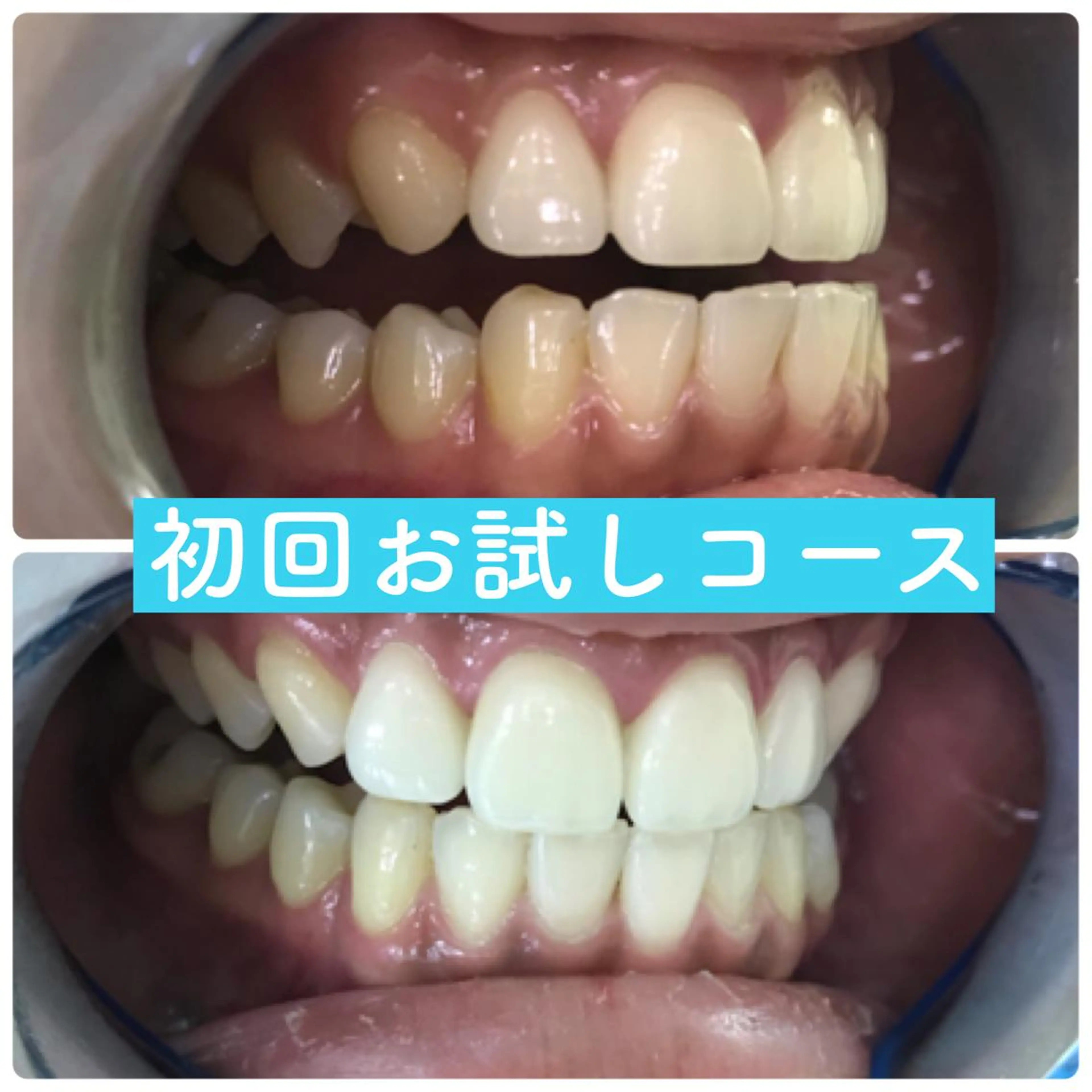 ホワイトニングルーム 横浜店のその他イメージ