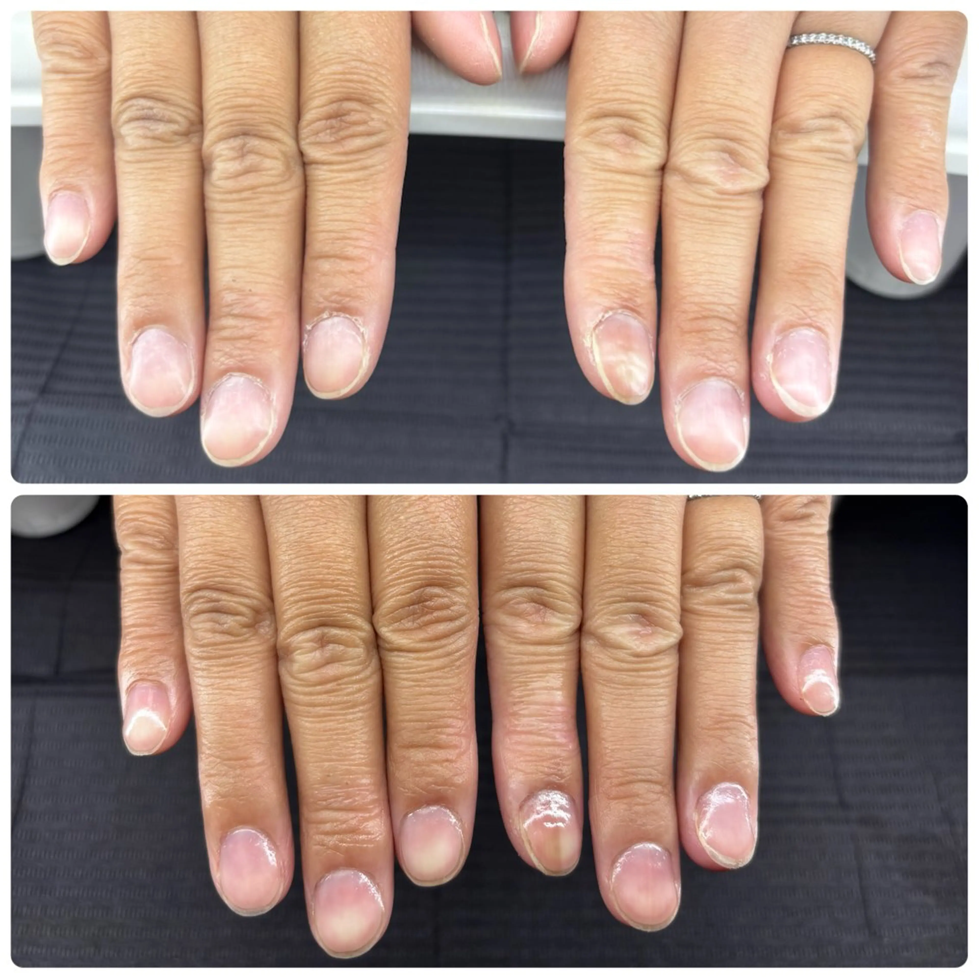 ミニモ限定価格‼️自爪育成🌱初回体験✨の写真