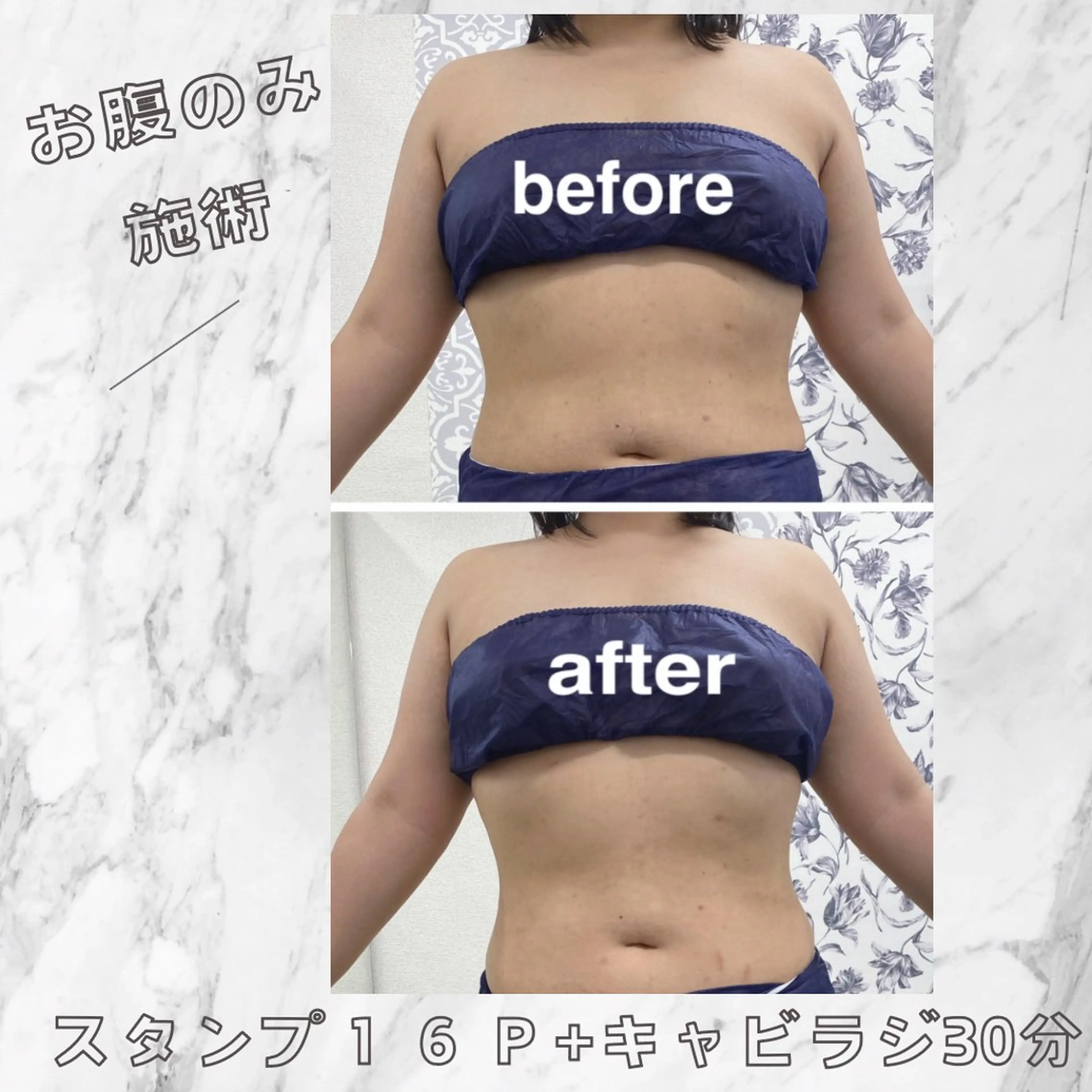 小顔痩身HALO 二宮早織のエステ・リラクイメージ