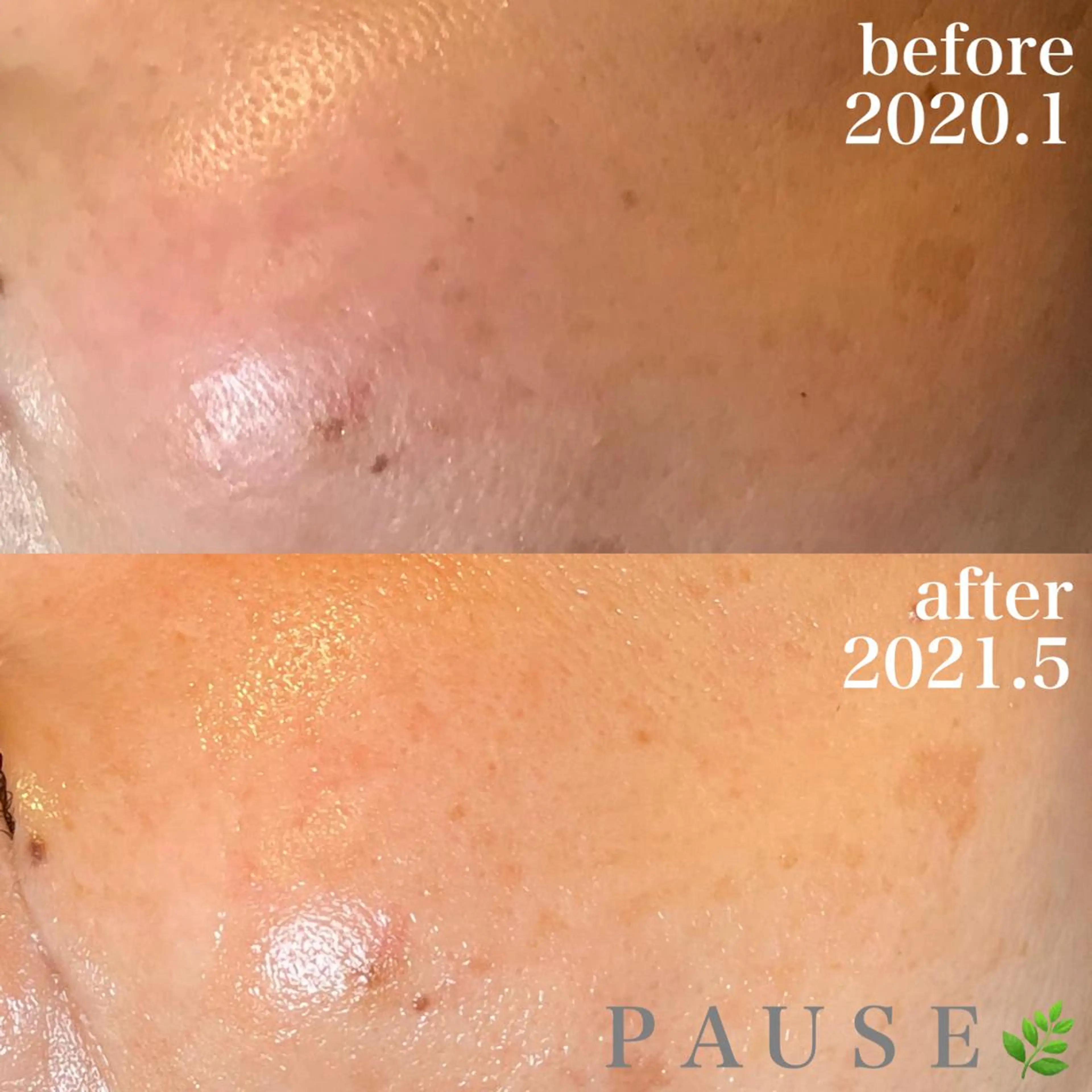 エステ 浜野 恵美のエステ・リラクイメージ