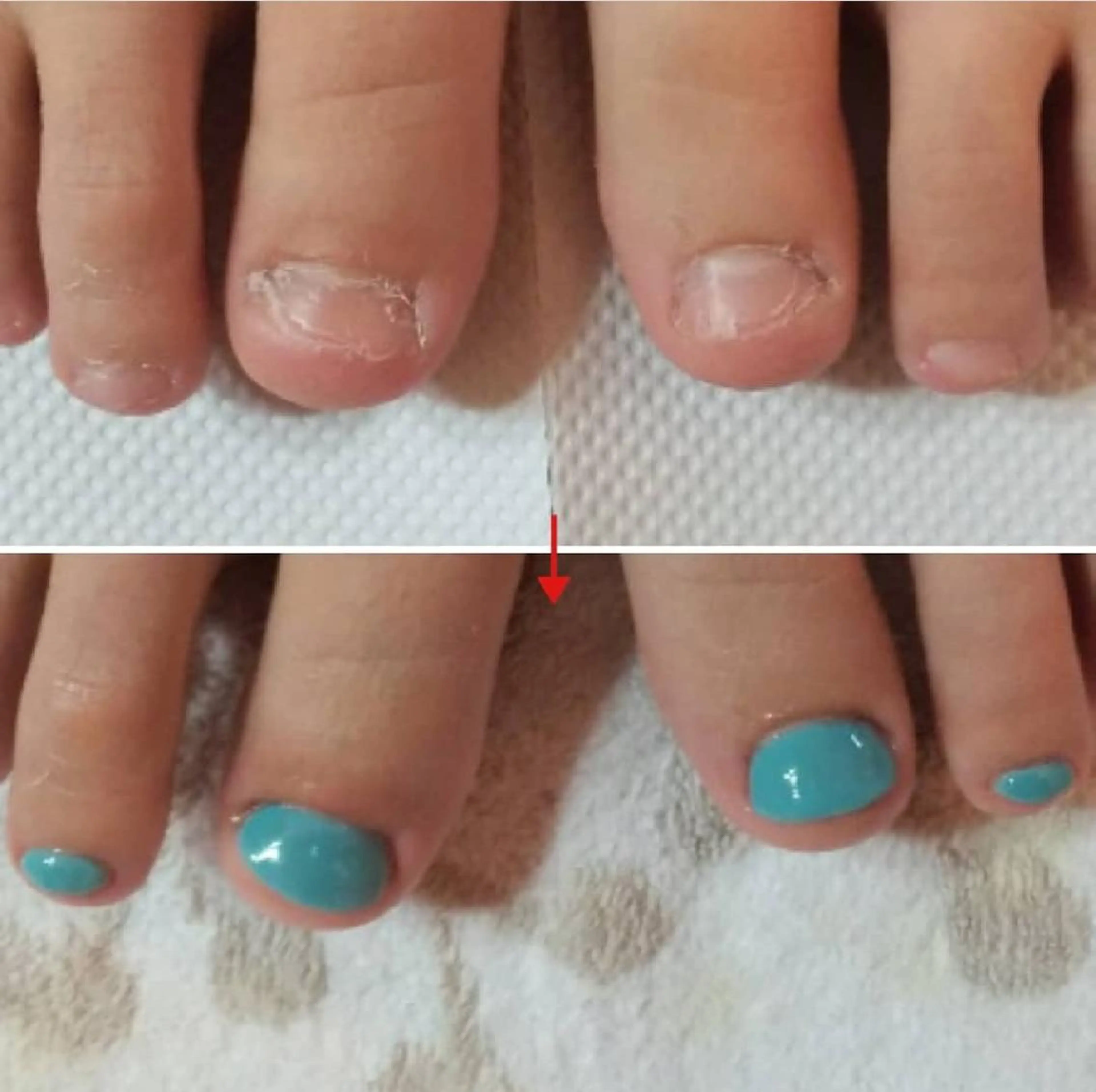 ネイル フットネイル ネイルサロンアリューム所属・ネイルサロン アリュームのネイルデザイン