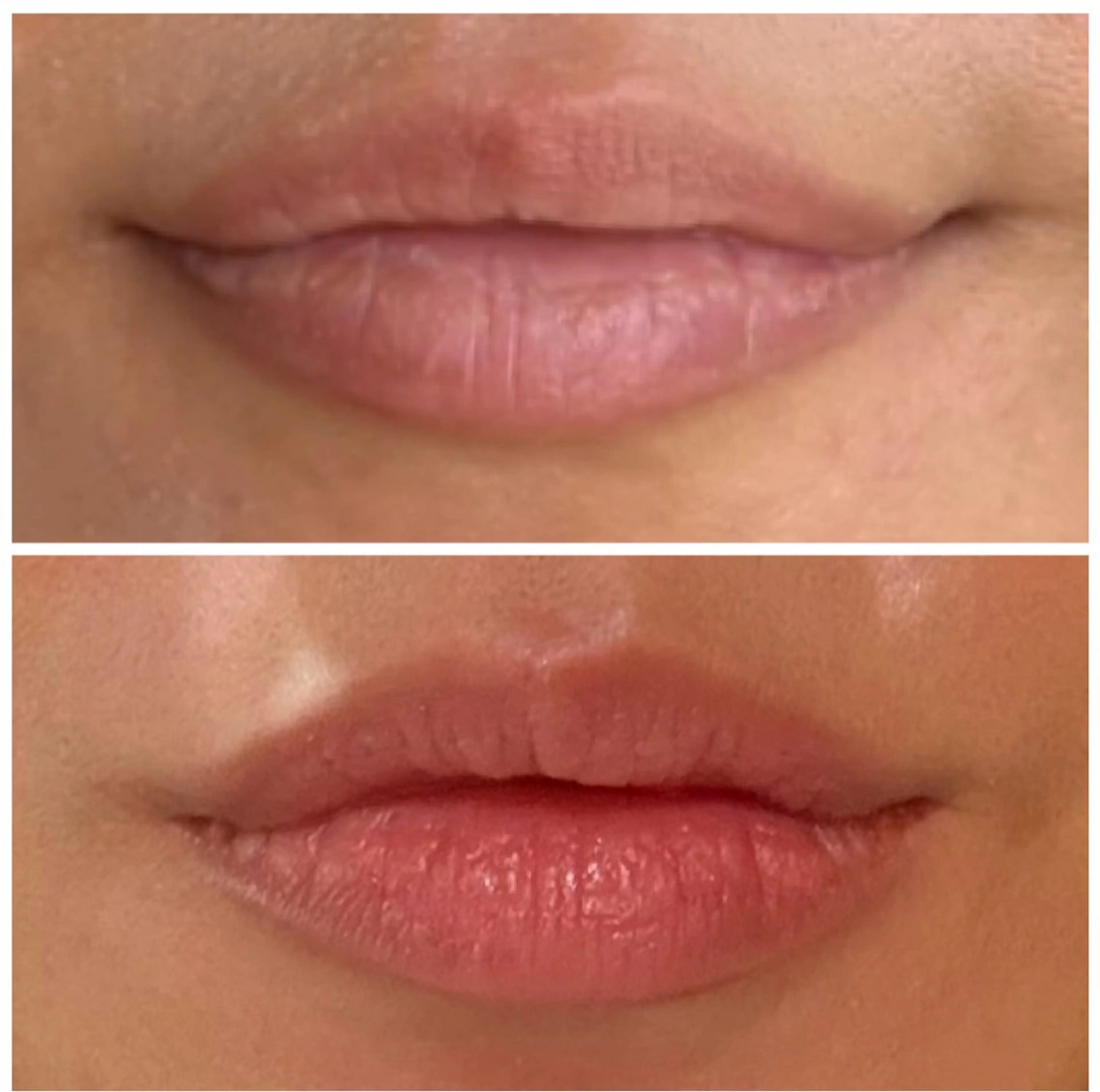 温活×デトックス 発酵野草蒸しのエステ・リラクイメージ