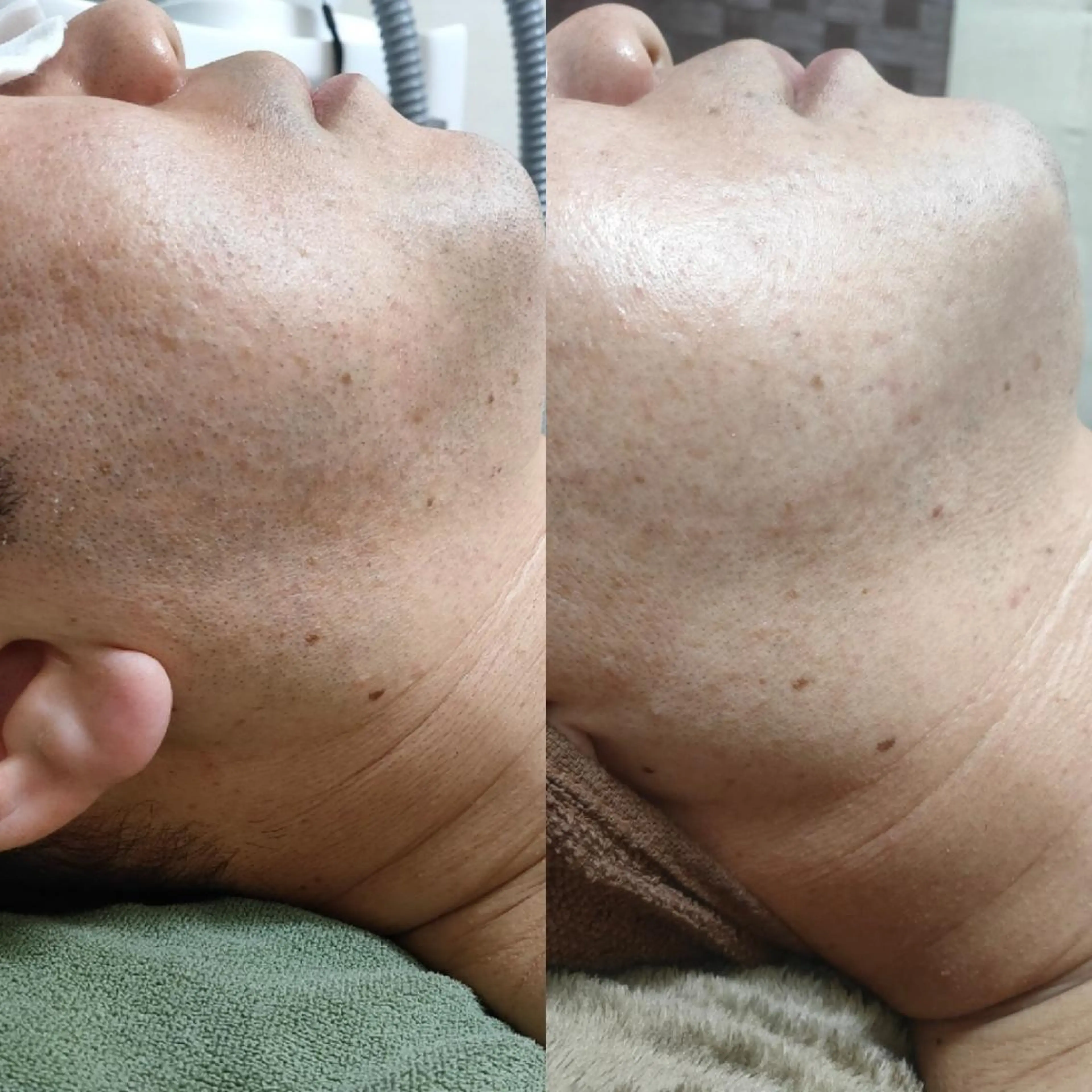 メンズ 武 藤のエステ・リラクイメージ