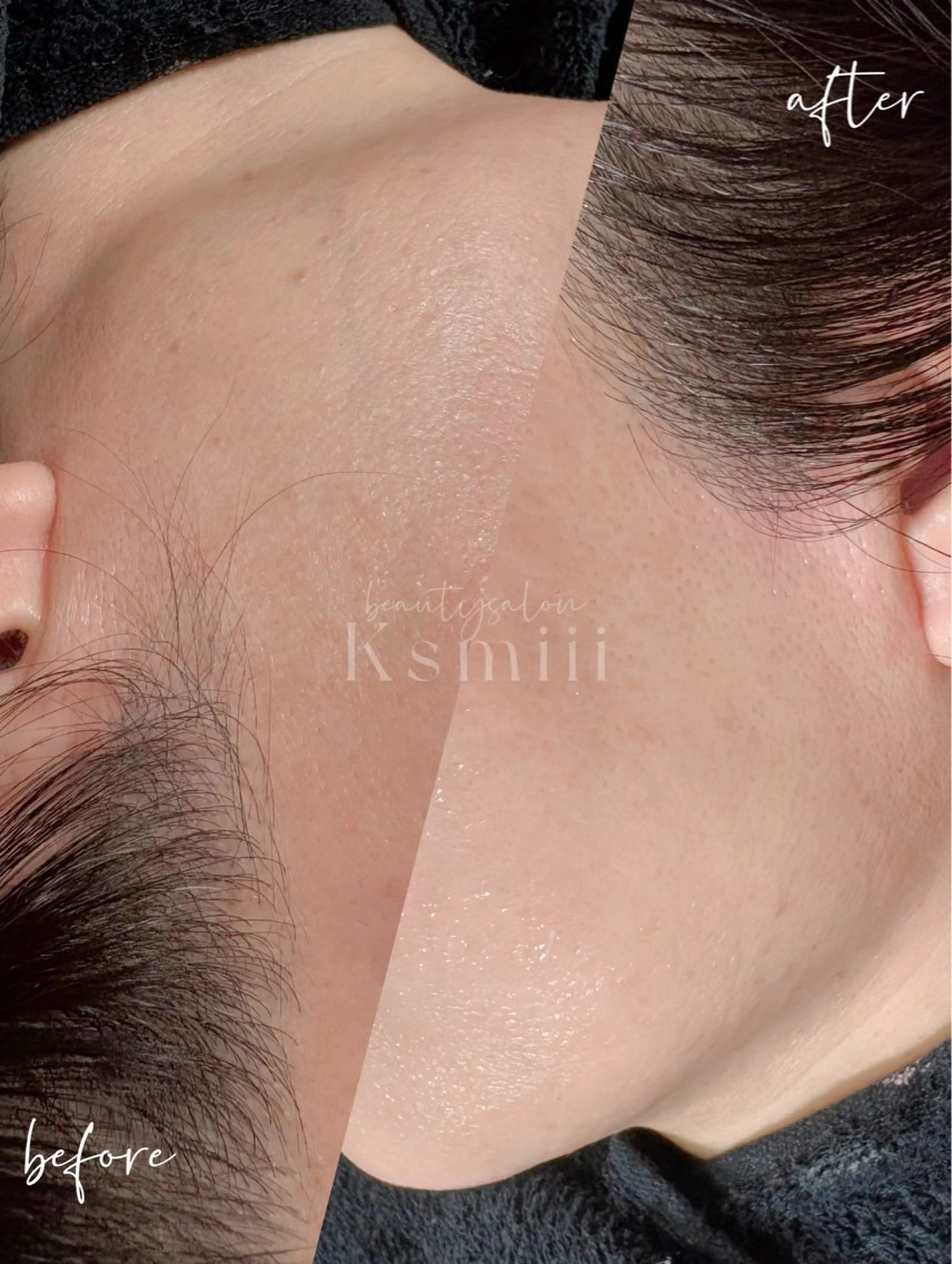 フェイスワックスの写真