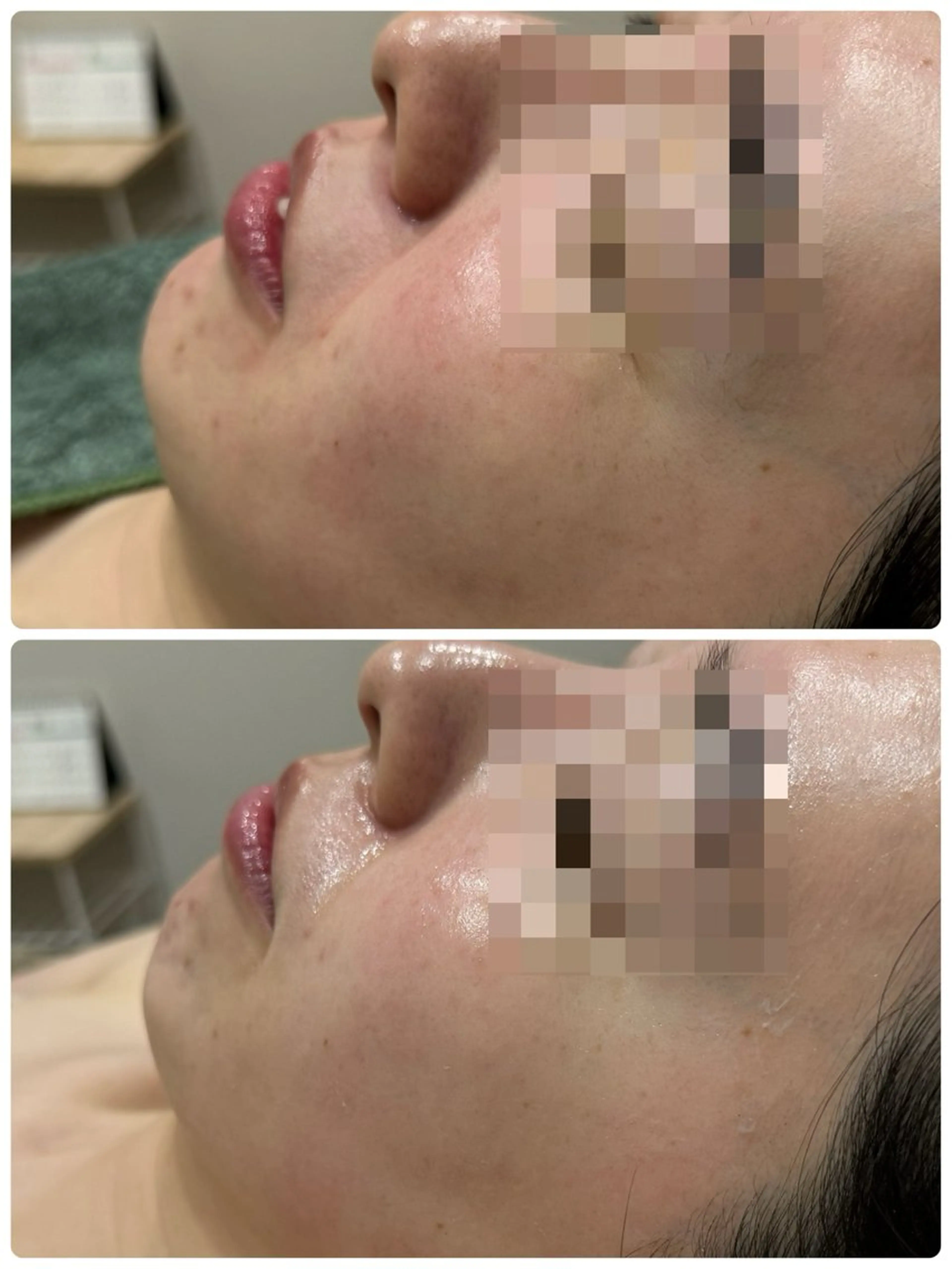 エステ 脱毛&フェイシャル 専門店muro.のエステ・リラクイメージ