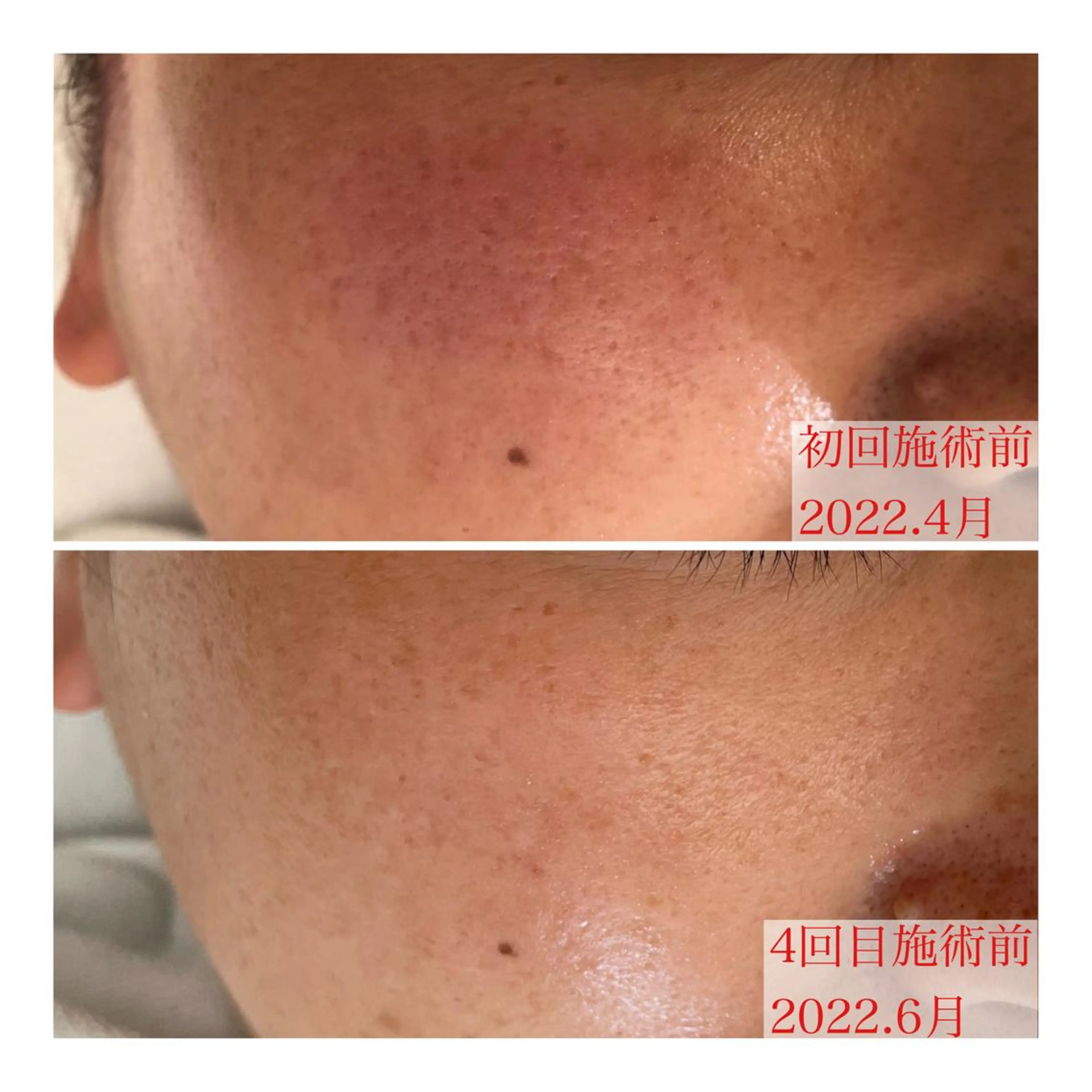 毛穴ケア専門サロン レーヌのエステ・リラクイメージ