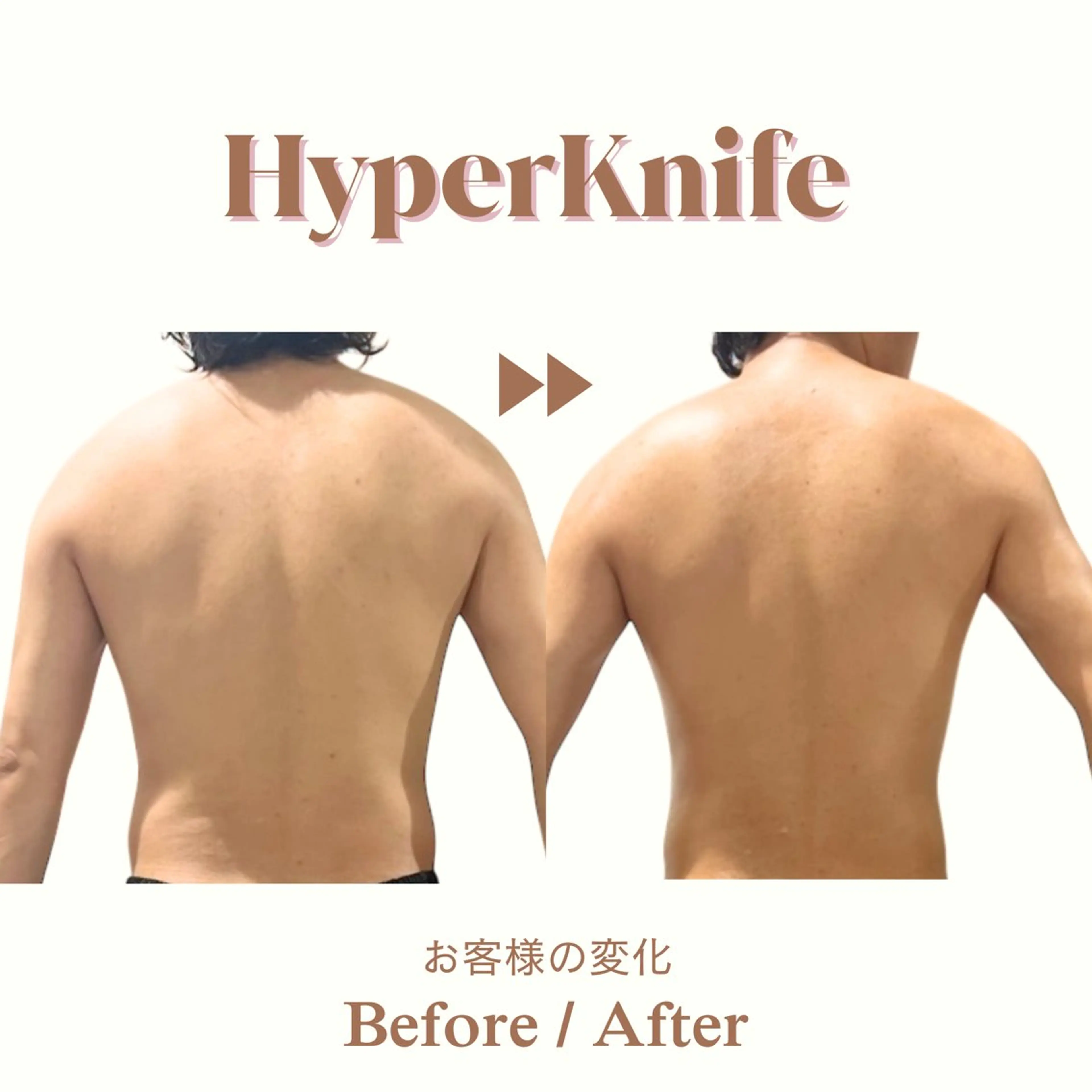 aimer服部 /  小顔 ・ 痩身のその他イメージ