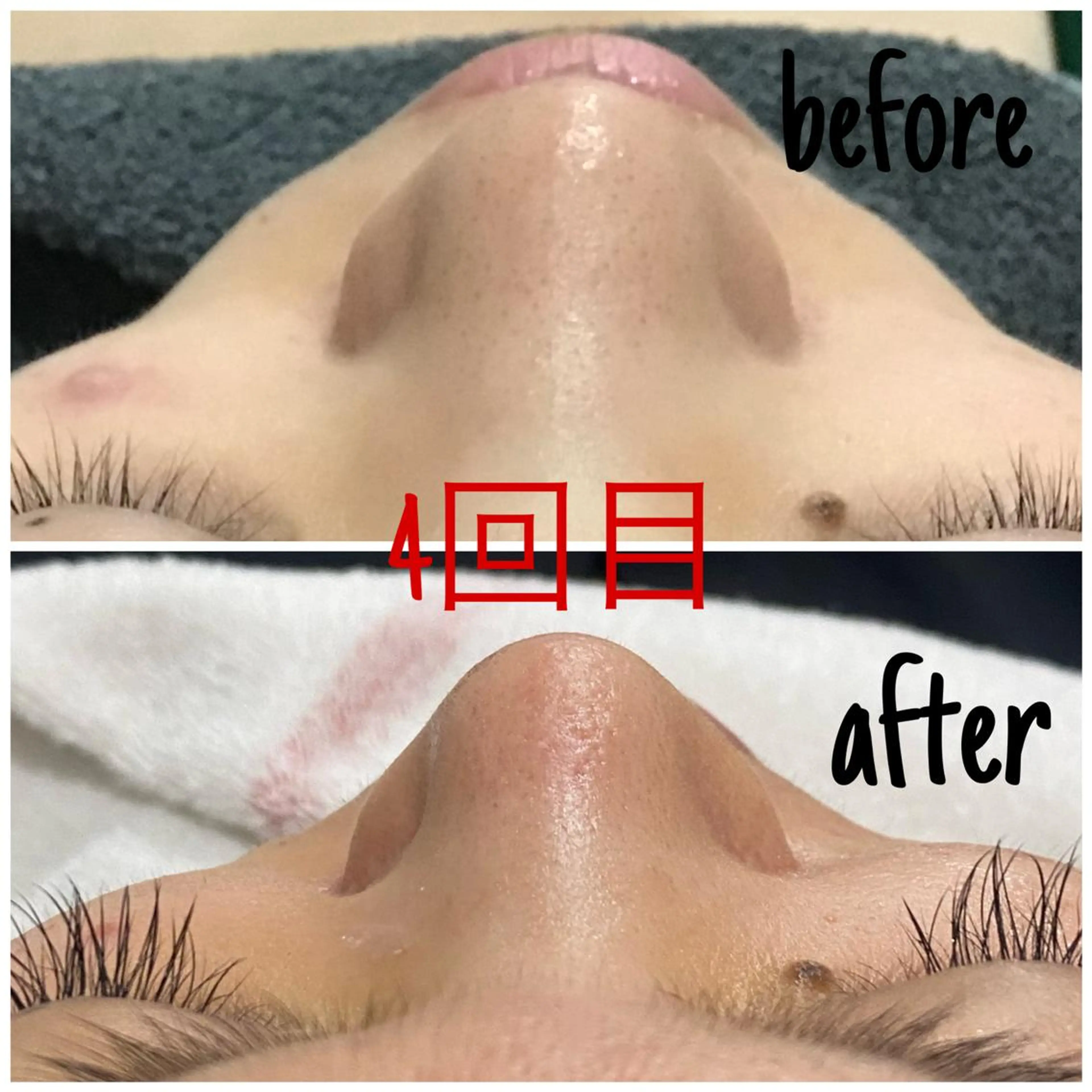 エステ 毛穴洗浄・痩身・脱毛 /アルカンジュのエステ・リラクイメージ