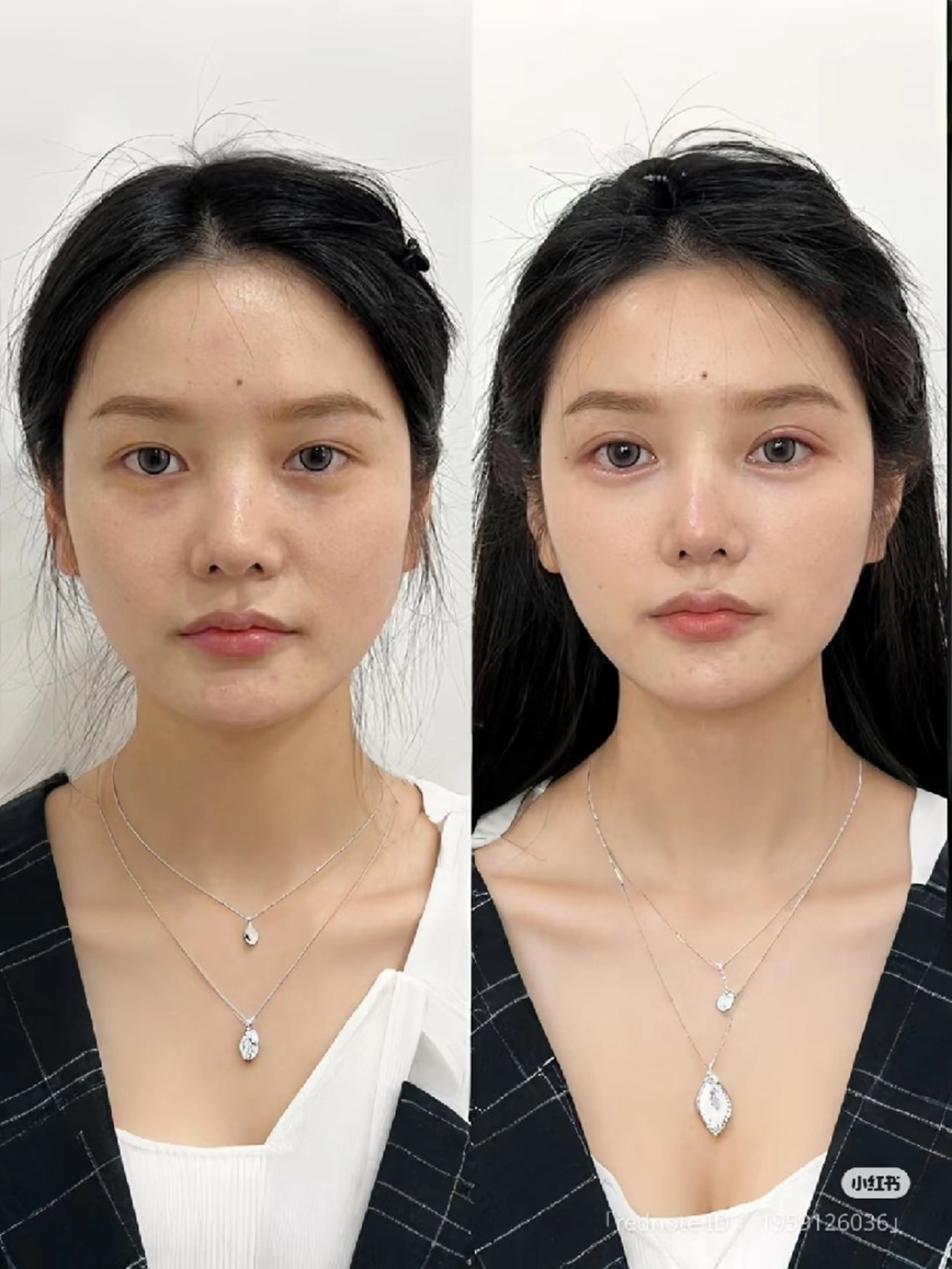 aliaハーブ水光店 エステティシャン募集のエステ・リラクイメージ