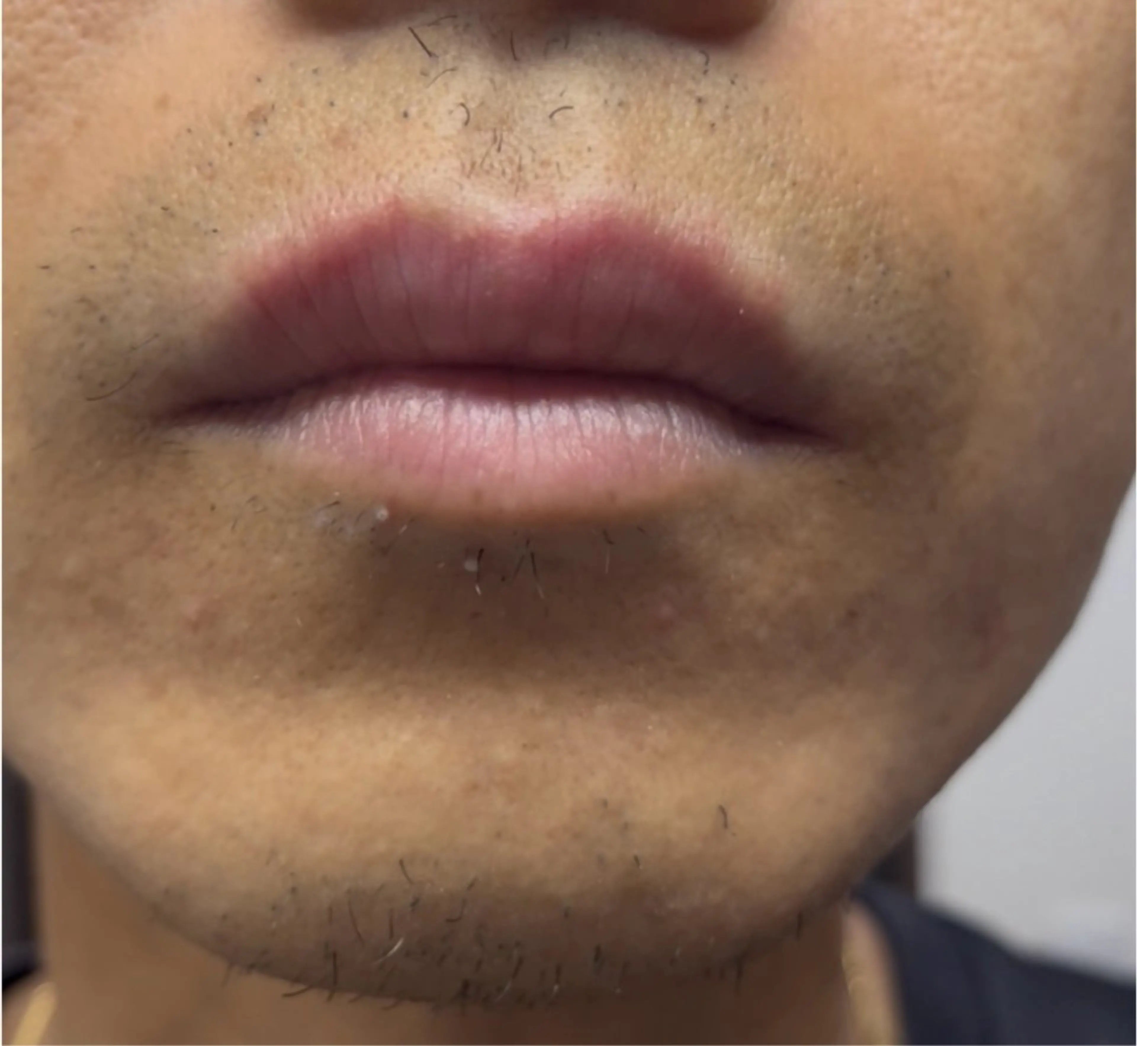 脱毛 脱毛屋 JiJiのエステ・リラクイメージ