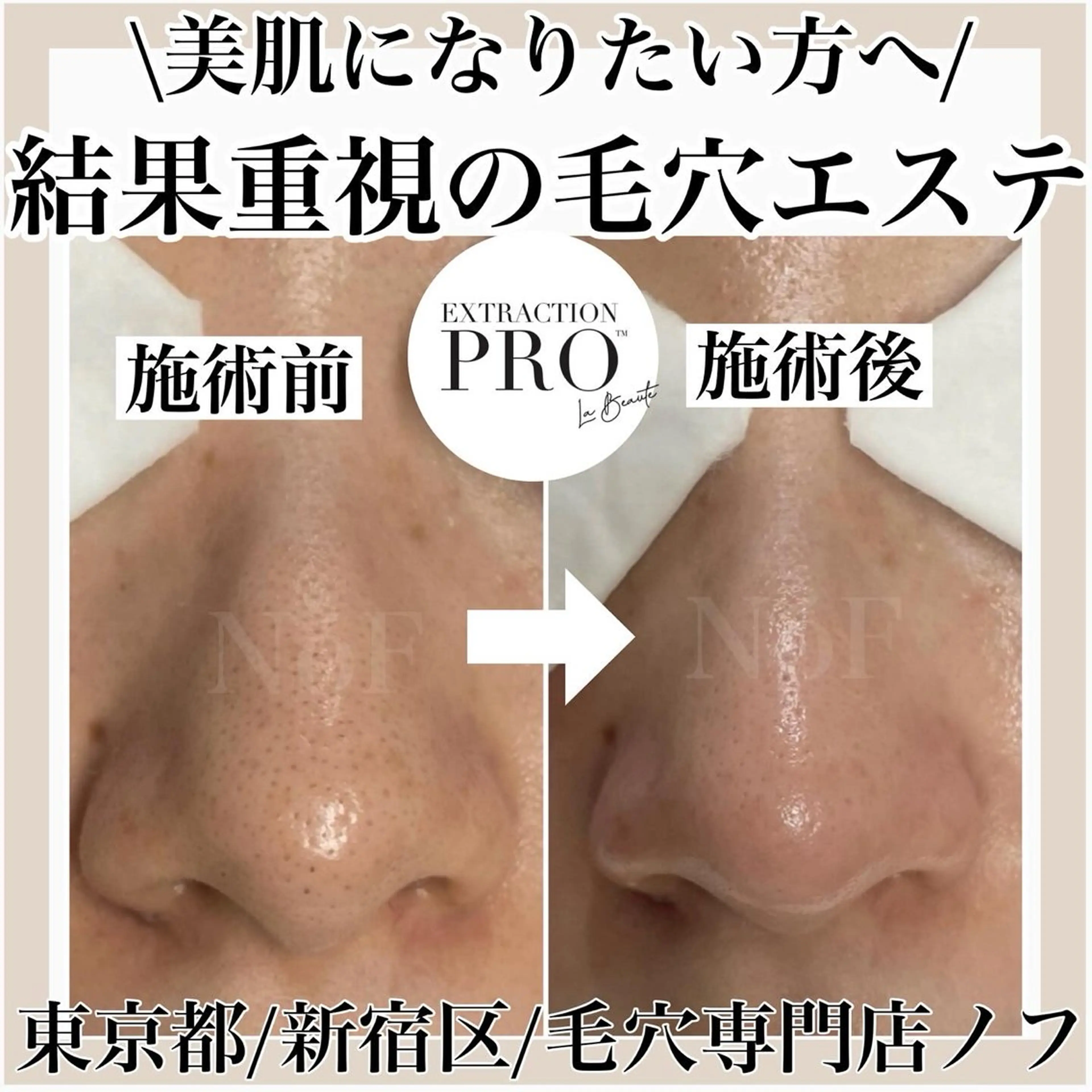 NóF .のマツエク・マツパデザイン