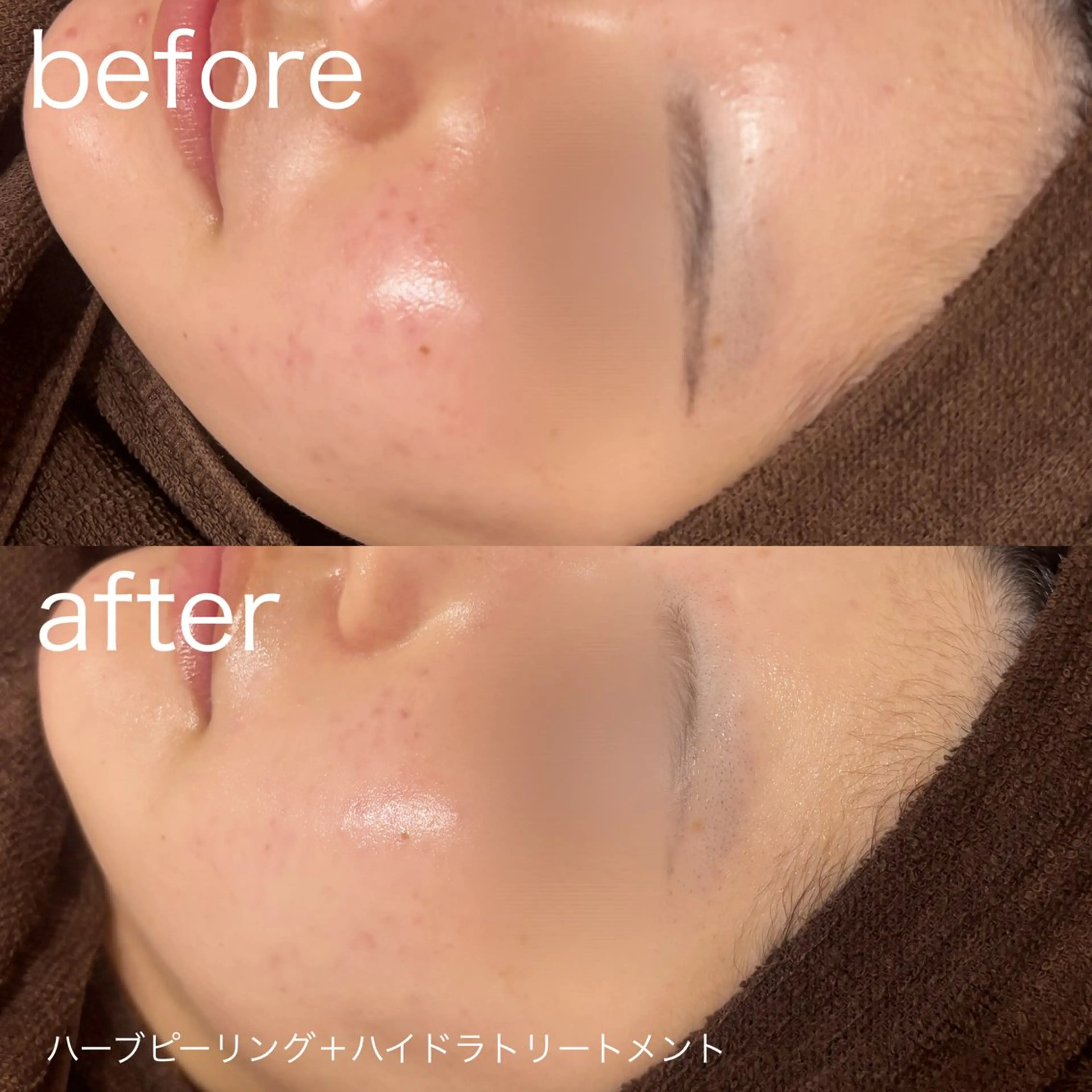 脱毛 lulularico Yuのエステ・リラクイメージ