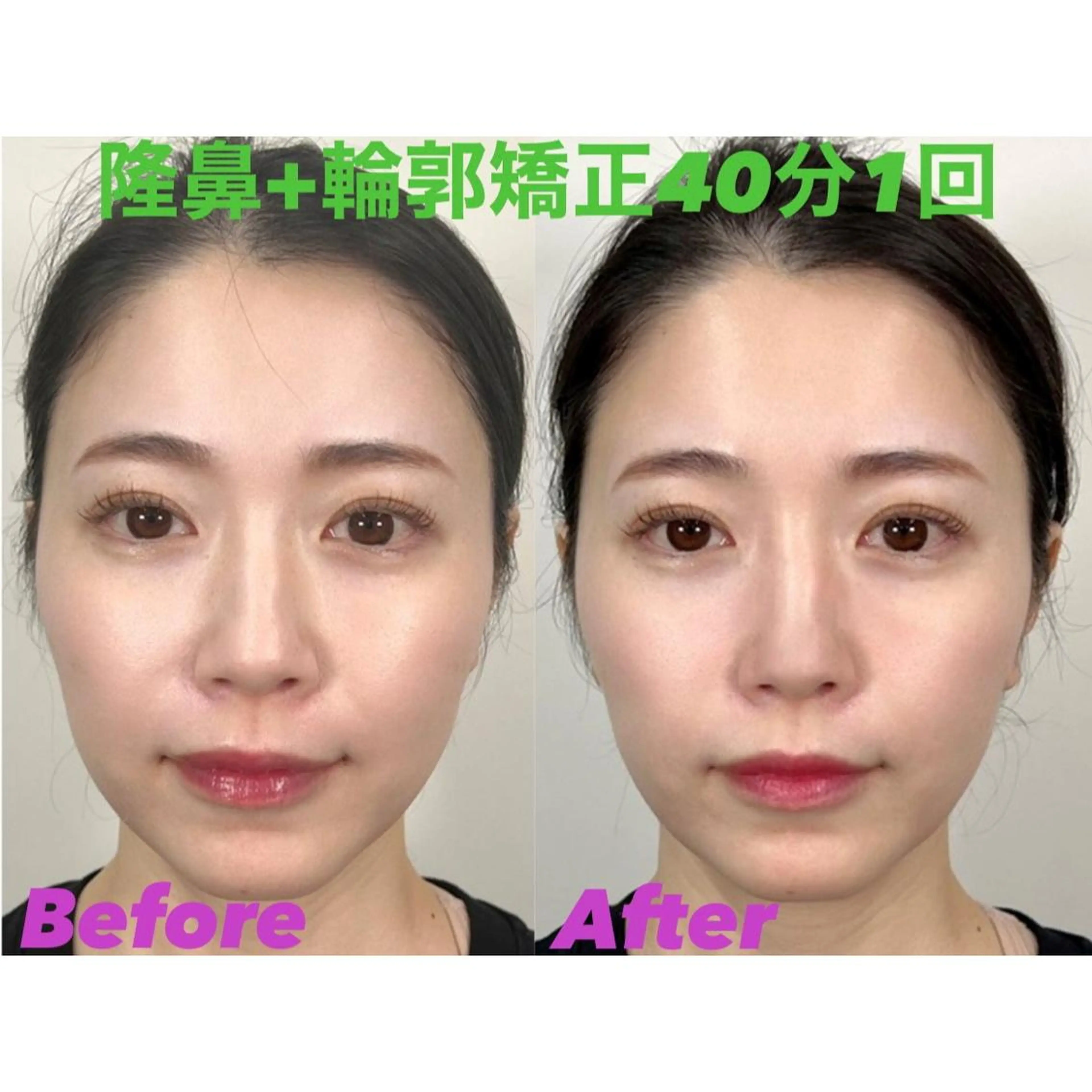 エステ リラク 隆鼻矯正専門店ラプリ 高橋のエステ・リラクイメージ