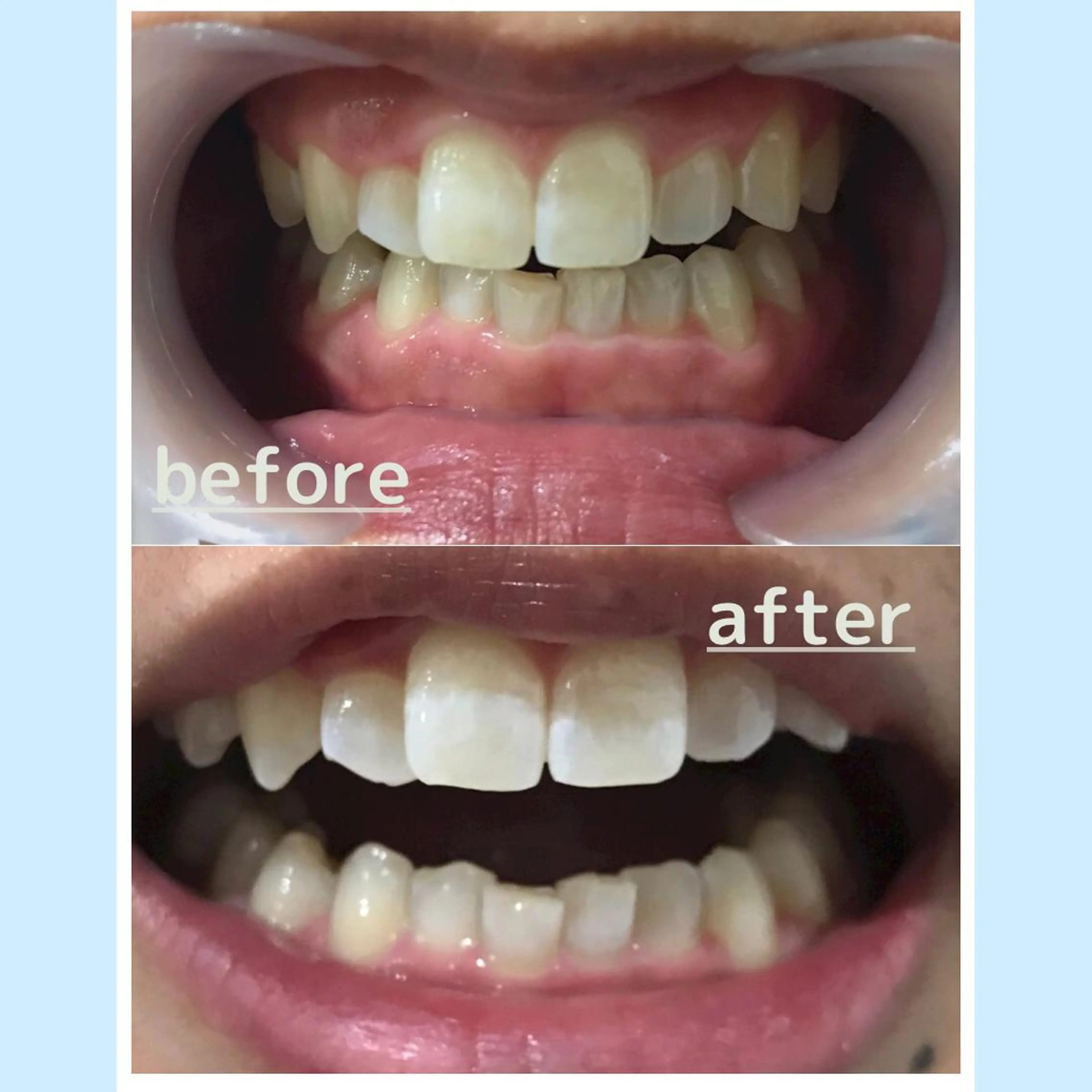 メンズ お手軽ホワイトニングsalon mina所属・武元 奈津美のその他イメージ