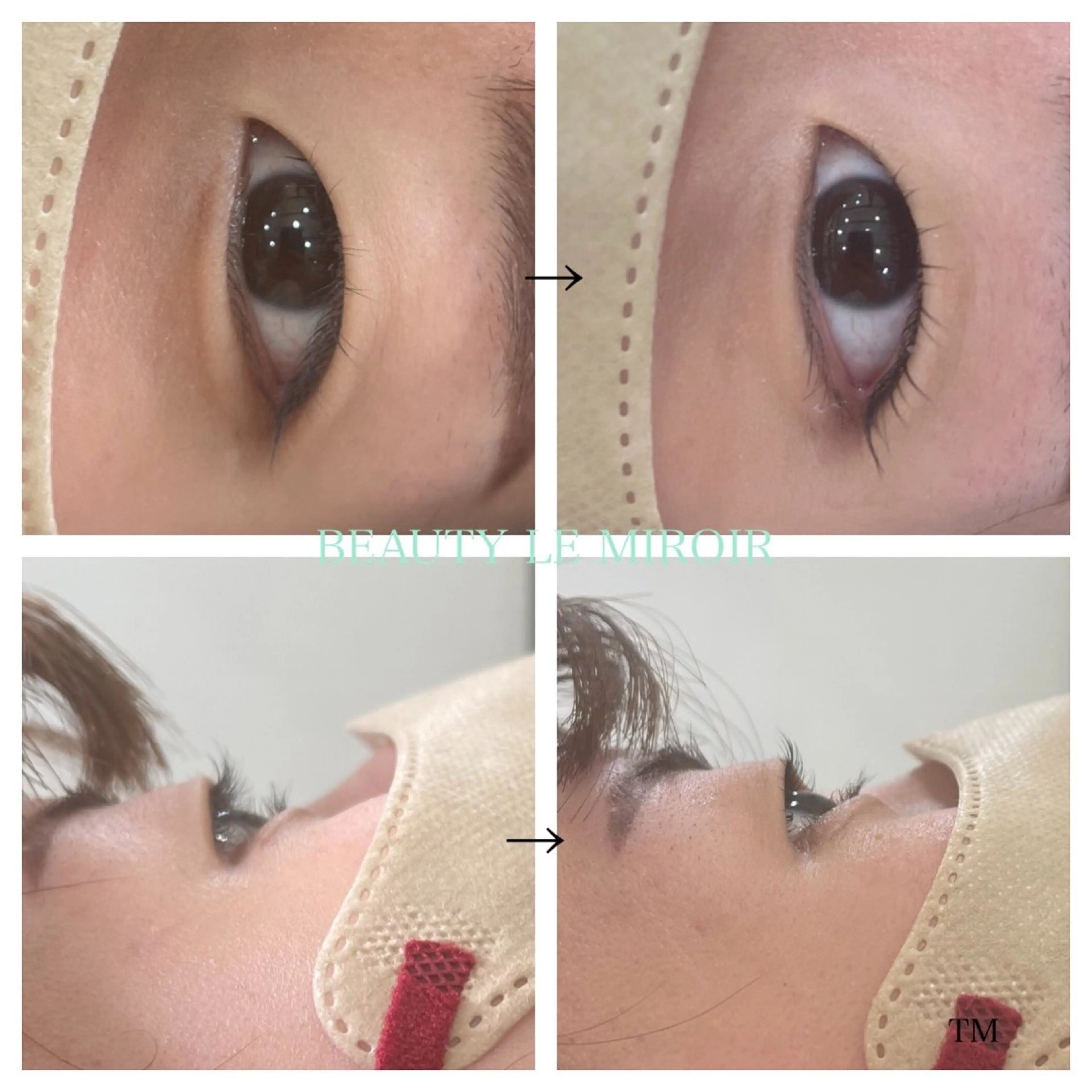 マツエク・マツパ ビューティー ミロワールのエステ・リラクイメージ