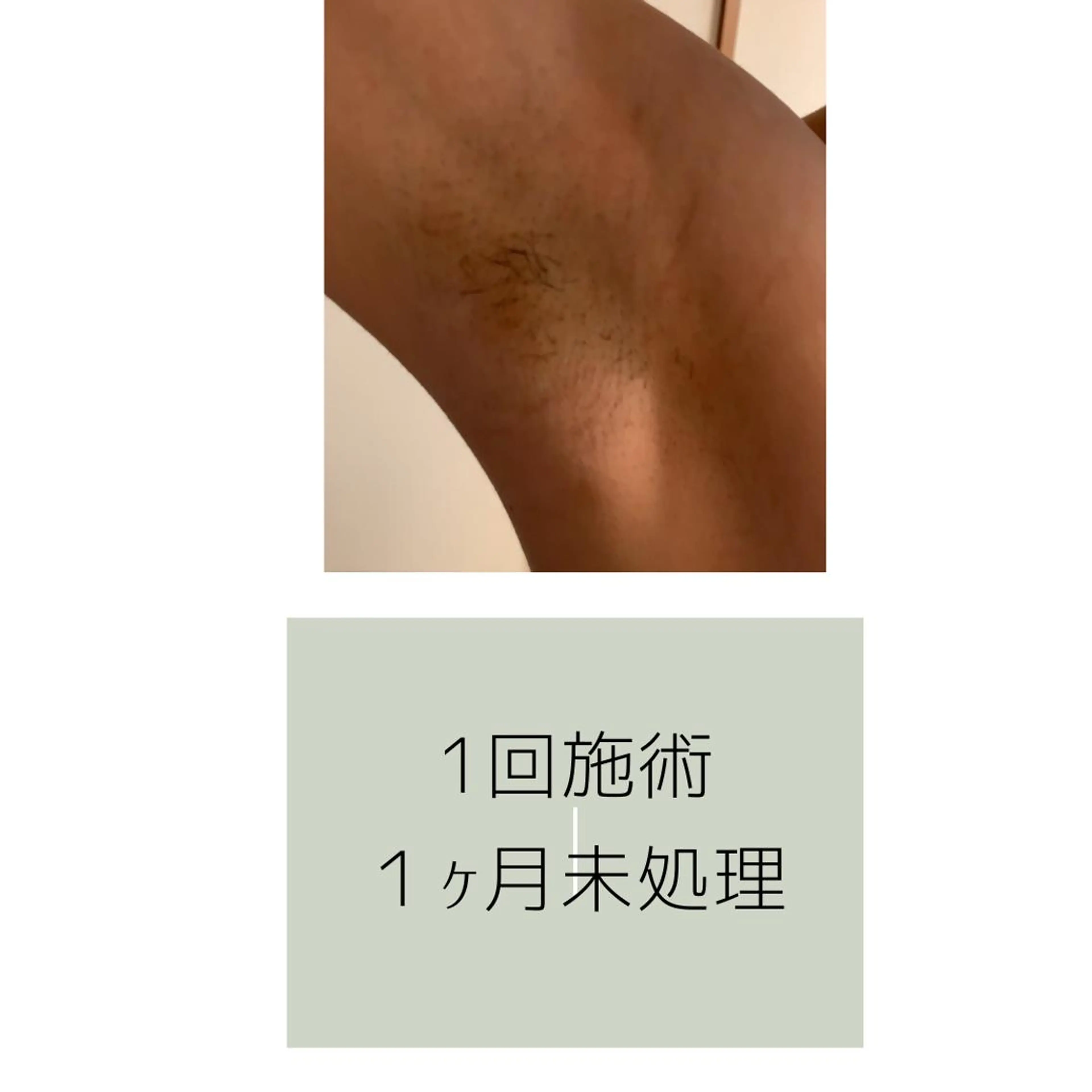 salon mijoaのエステ・リラクイメージ