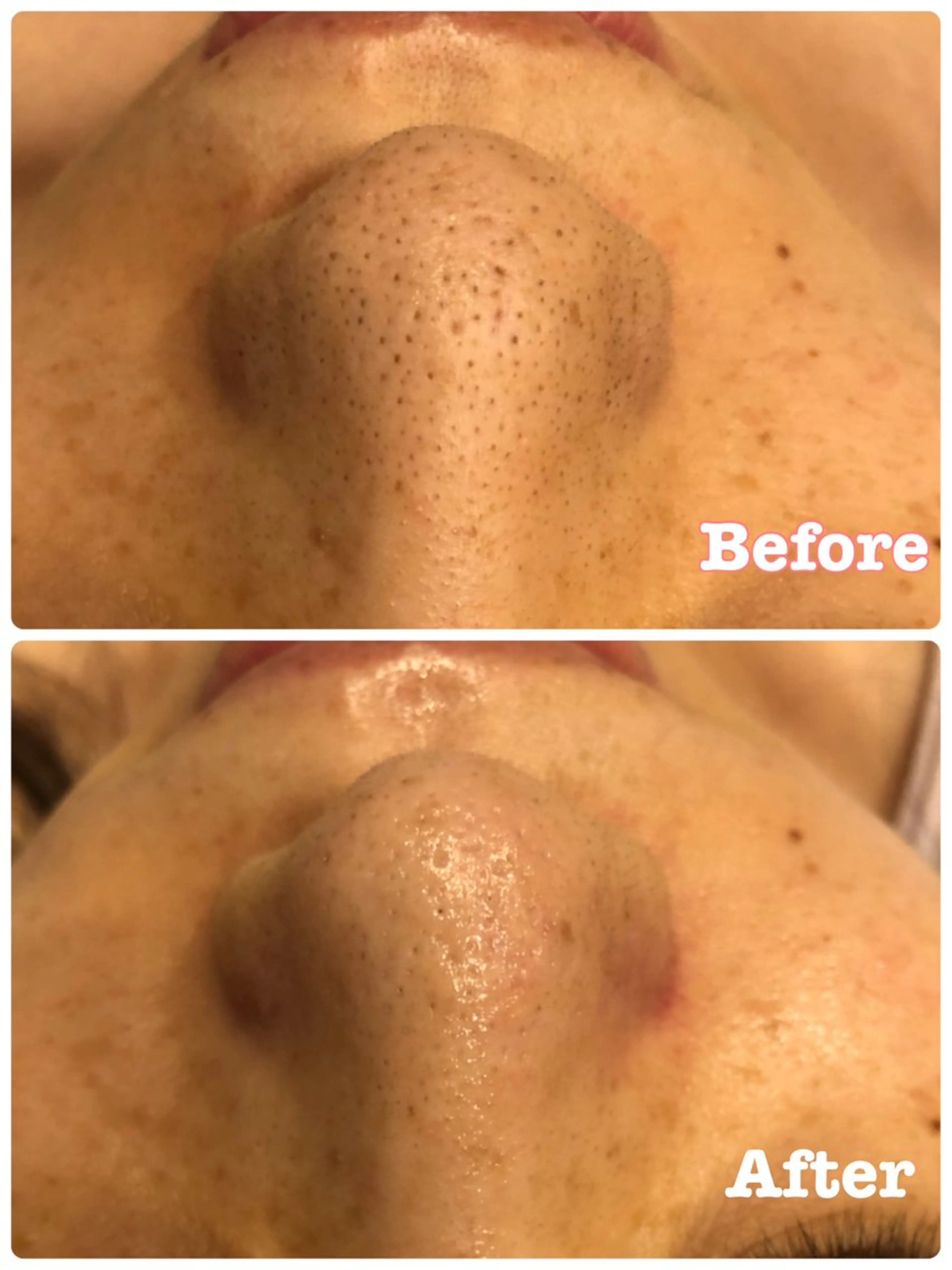 エステ 加藤 葵のエステ・リラクイメージ