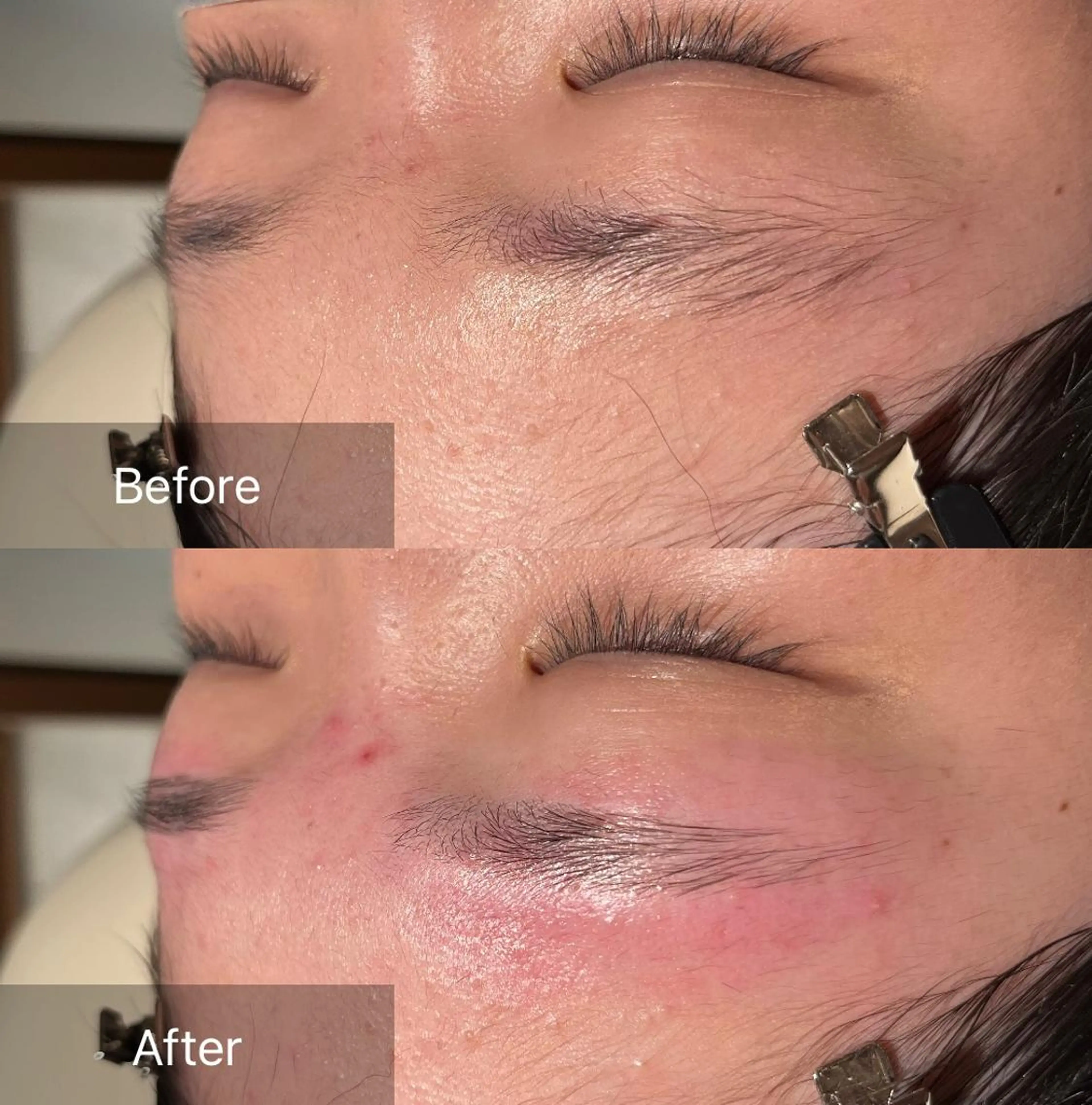 アイブロウ ワックス脱毛 眉カット その他(アイブロウ) 森 美優のエステ・リラクイメージ