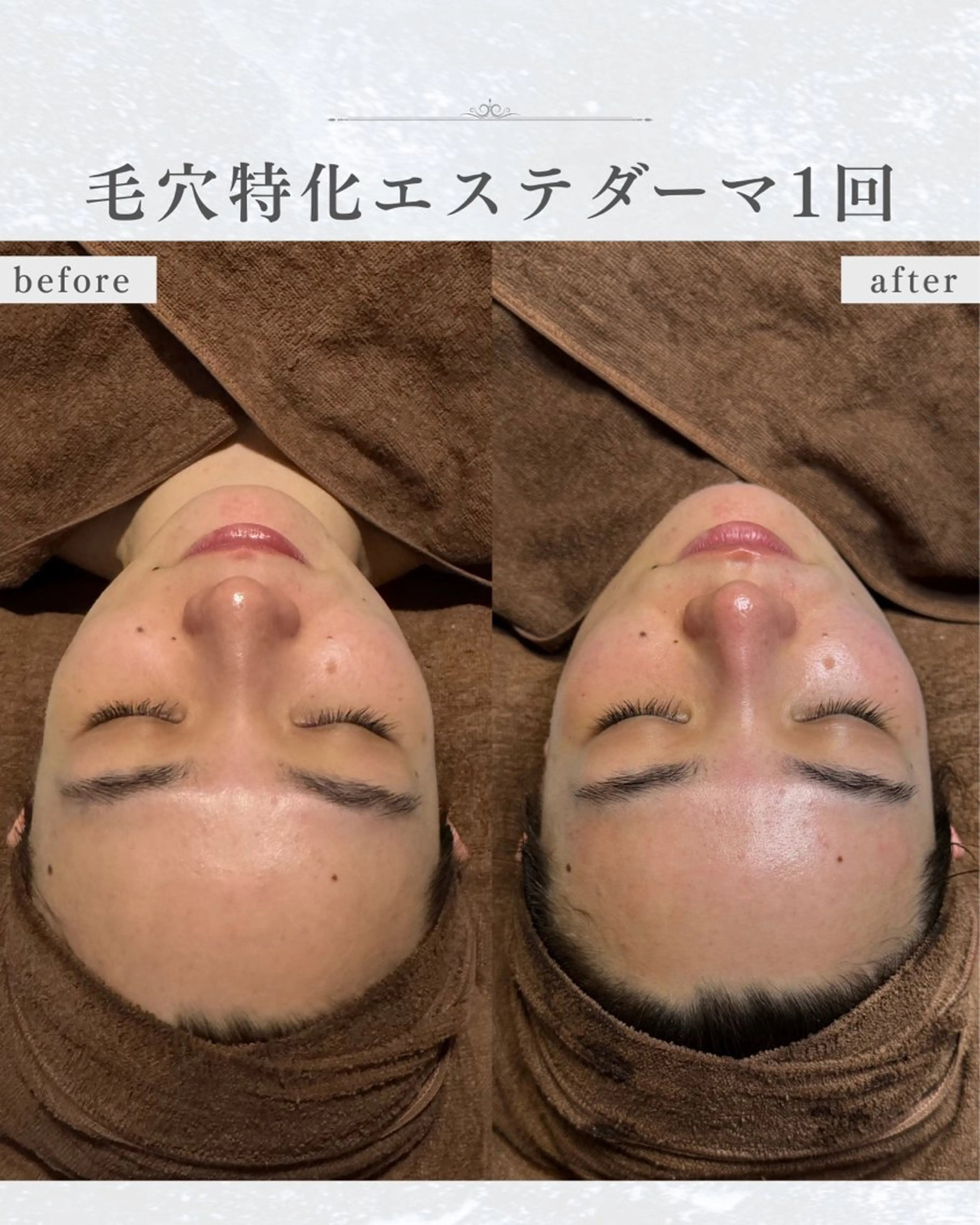 エステ シミ・毛穴ケア専門 クロヌYUKIのエステ・リラクイメージ