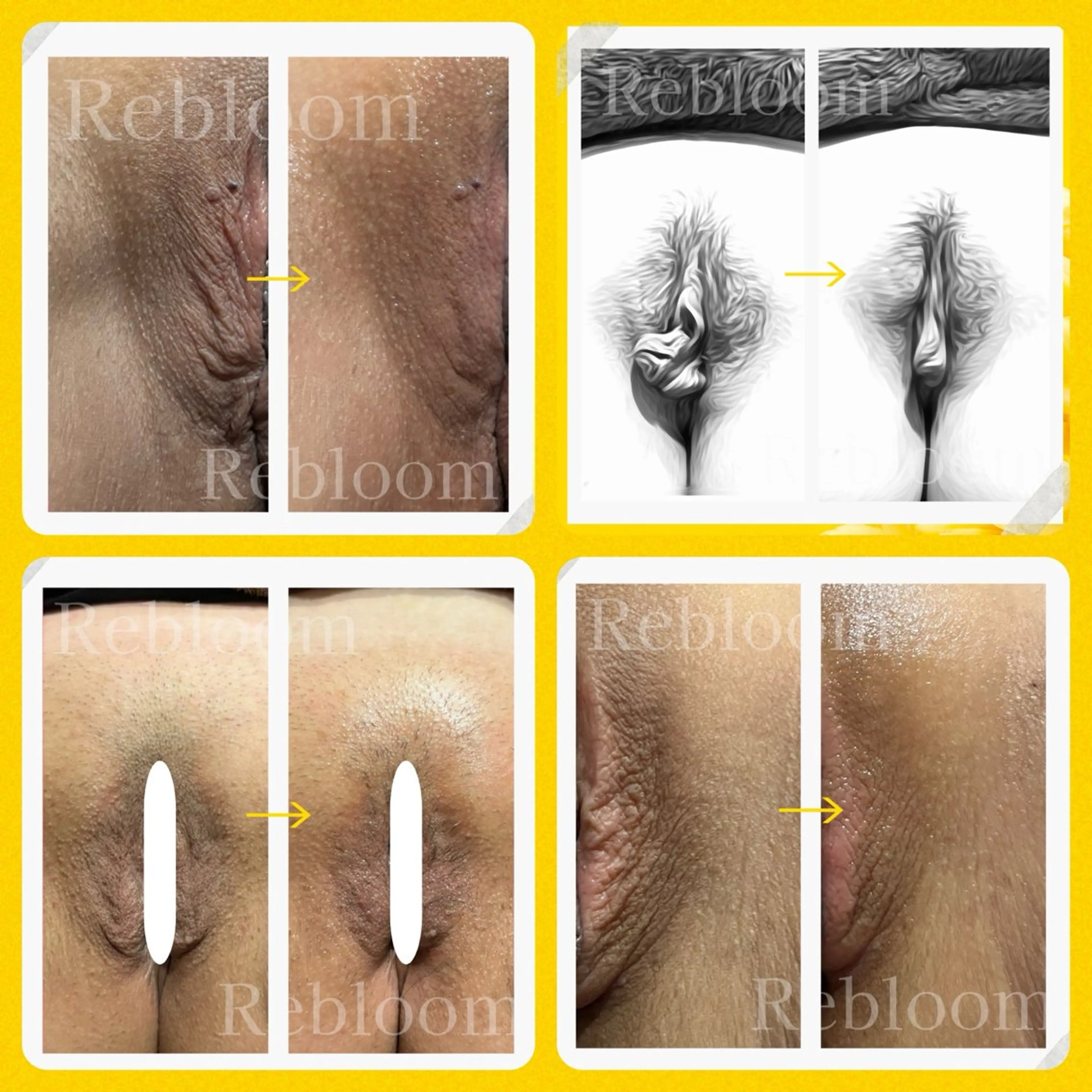 エステ デリケートな悩み解決 Rebloomのエステ・リラクイメージ