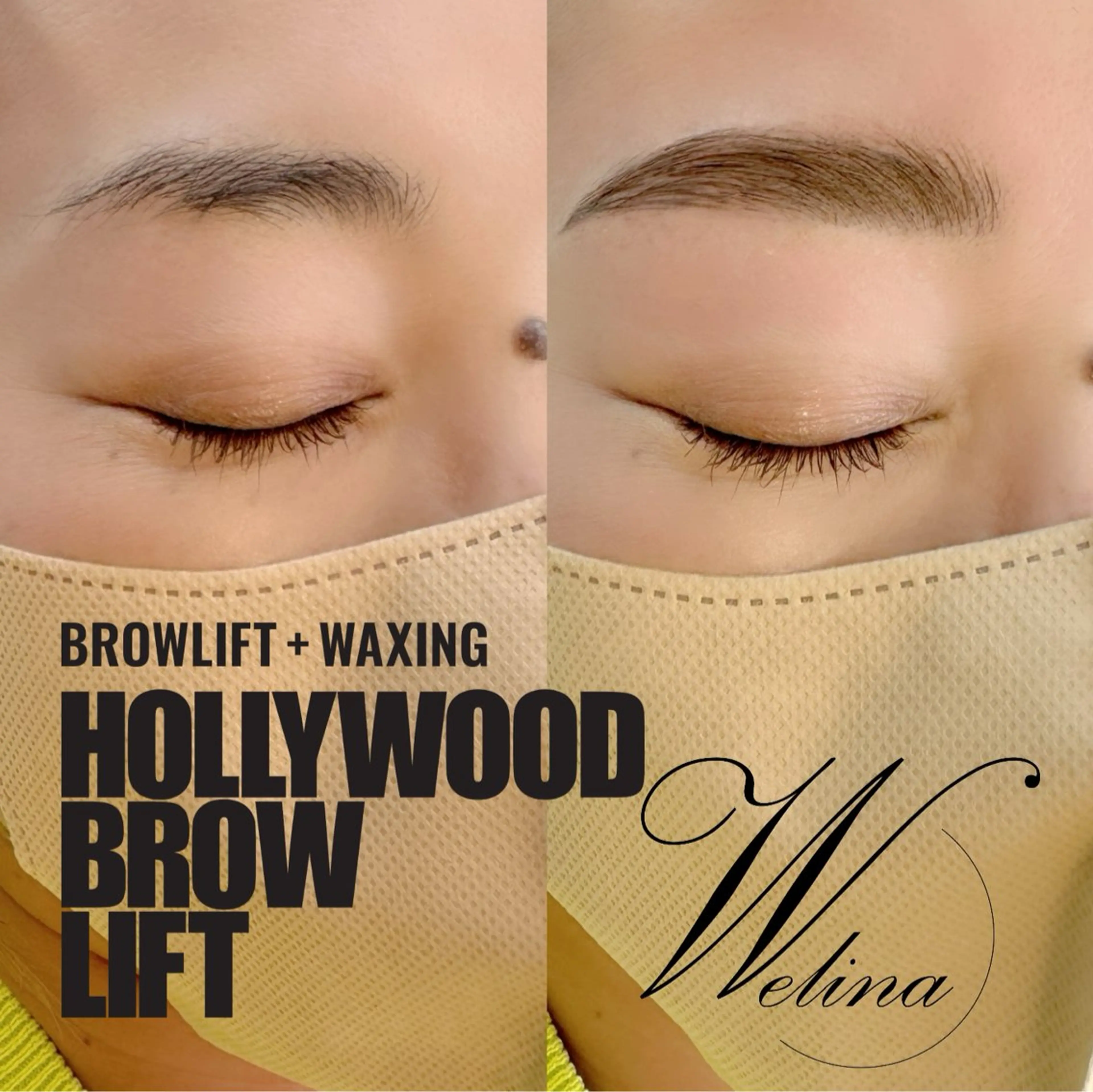 HBL/ハリウッドブロウリフトの写真