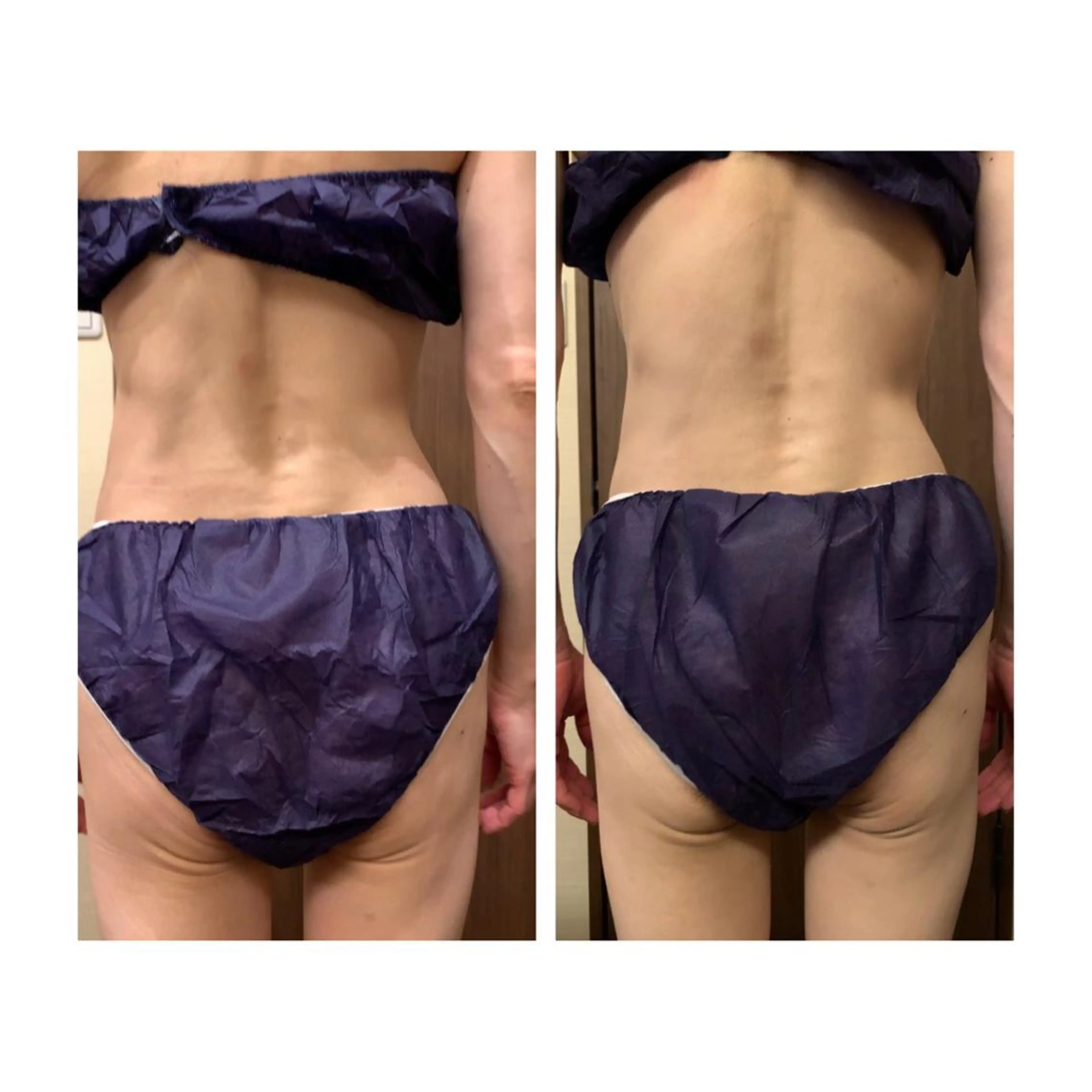 姿勢・体質・自律神経 ケアサロンCOTOのエステ・リラクイメージ