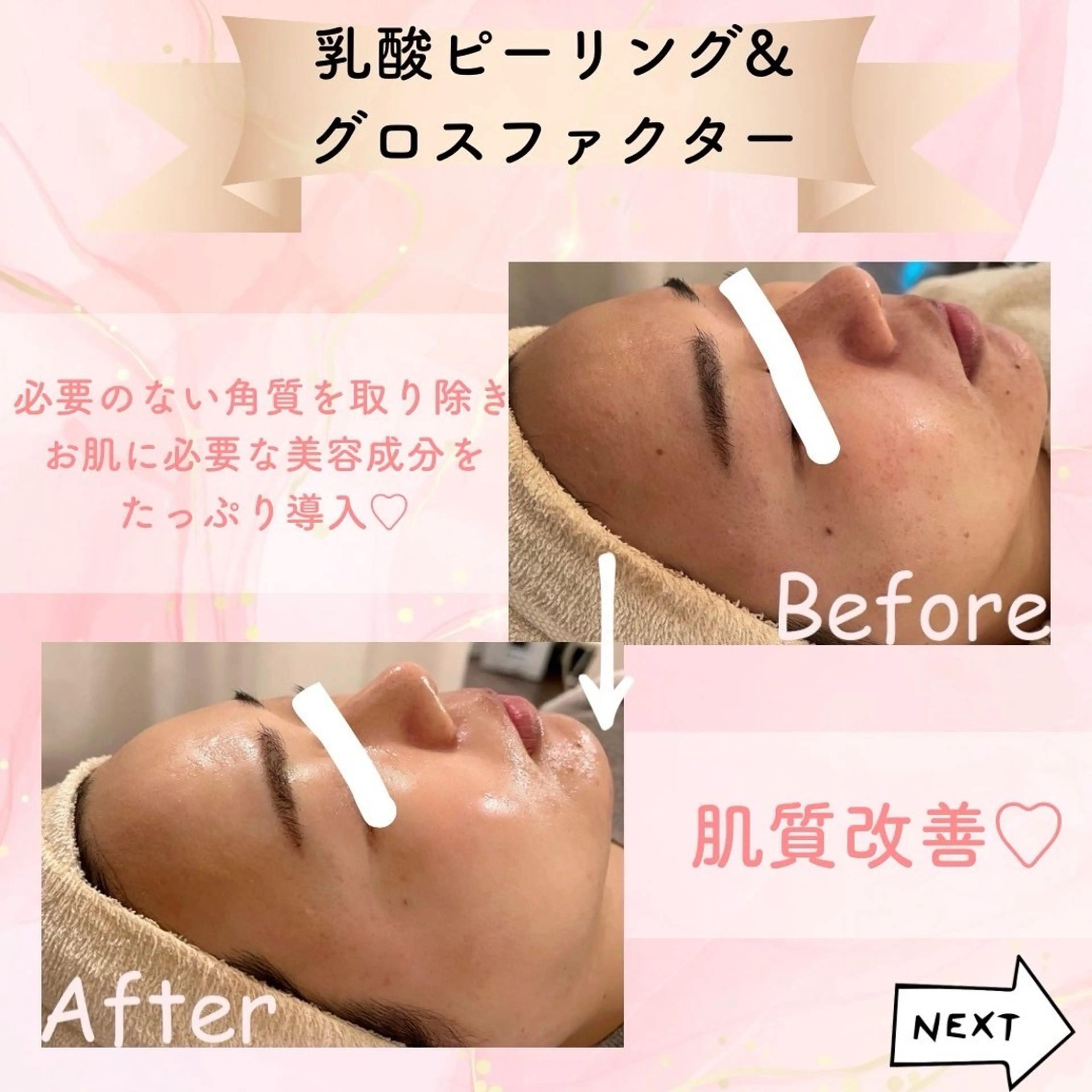 beauty SalonRcoinのマツエク・マツパデザイン