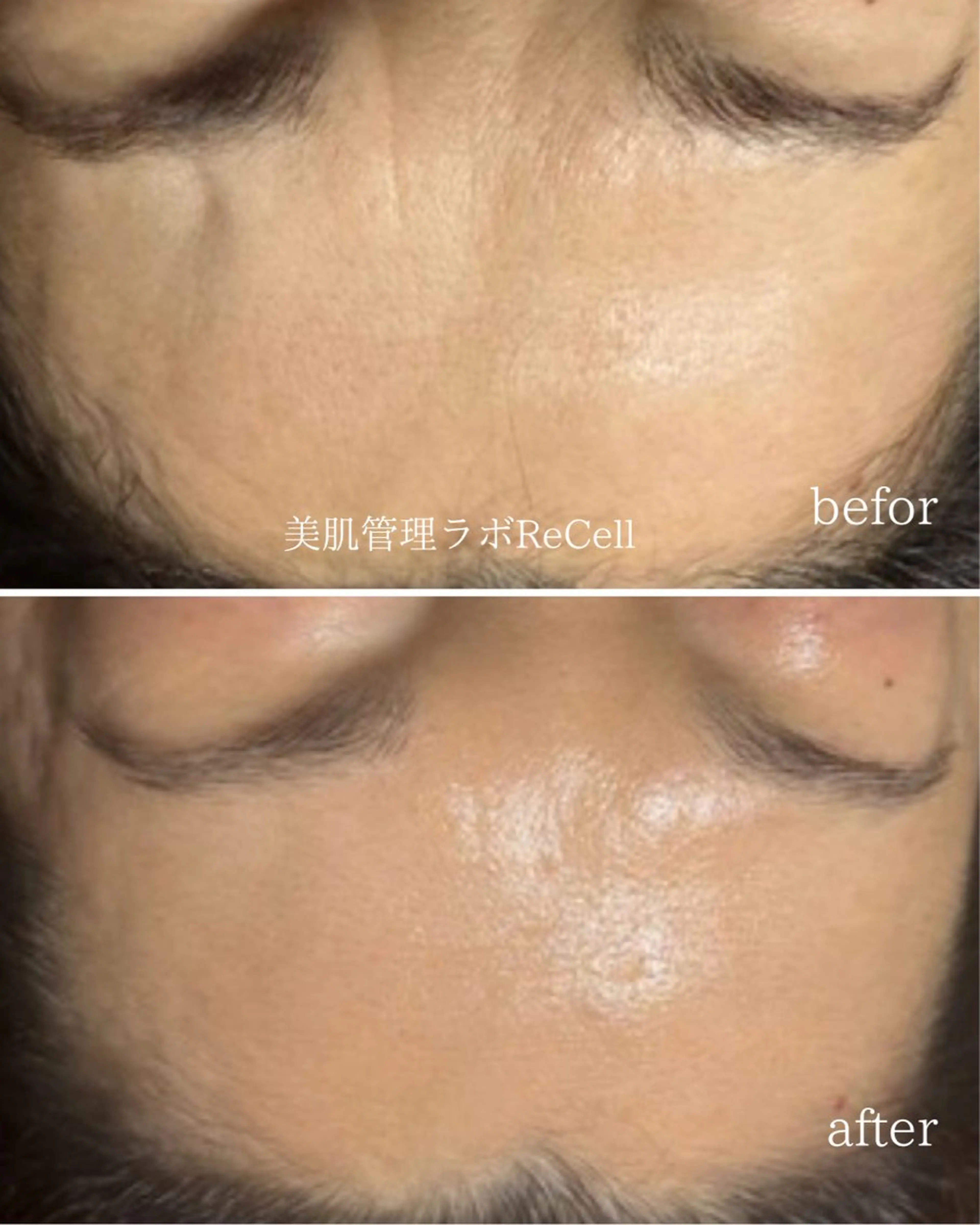 ReCell 肌管理のエステ・リラクイメージ