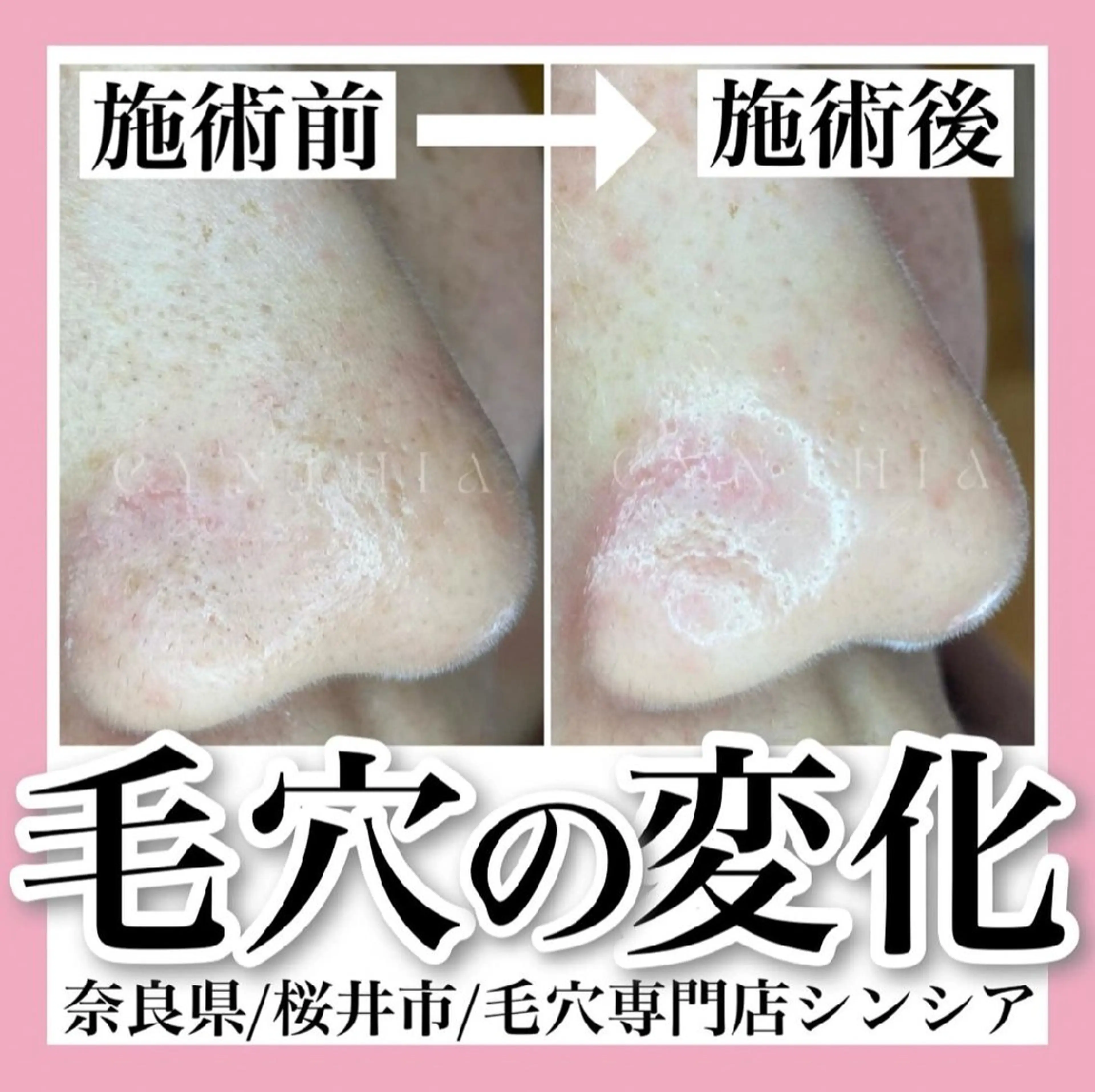 メンズ 毛穴ケア専門店 Cynthiaのエステ・リラクイメージ