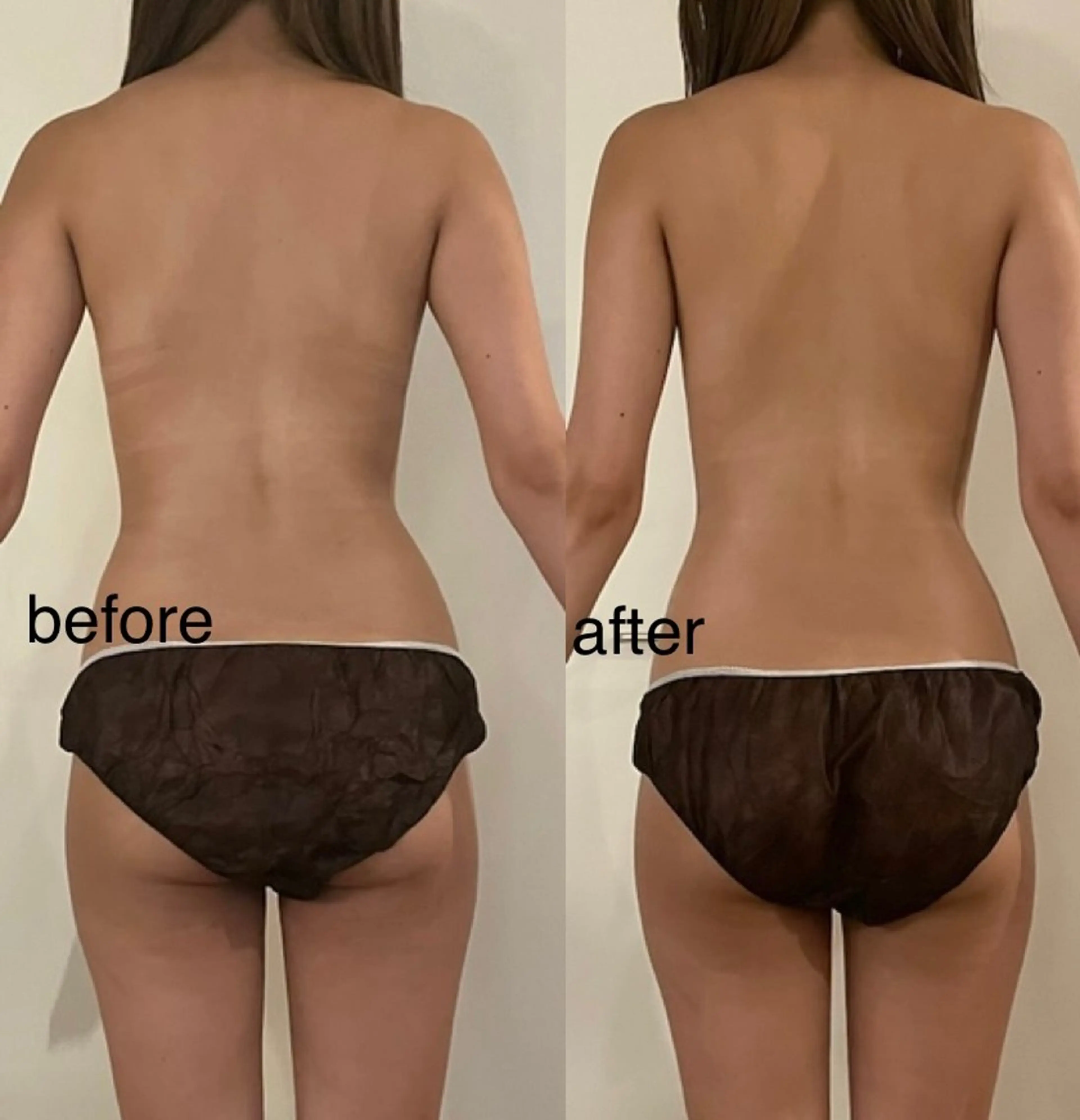 エステ リラク プライベートサロン シュシュのエステ・リラクイメージ