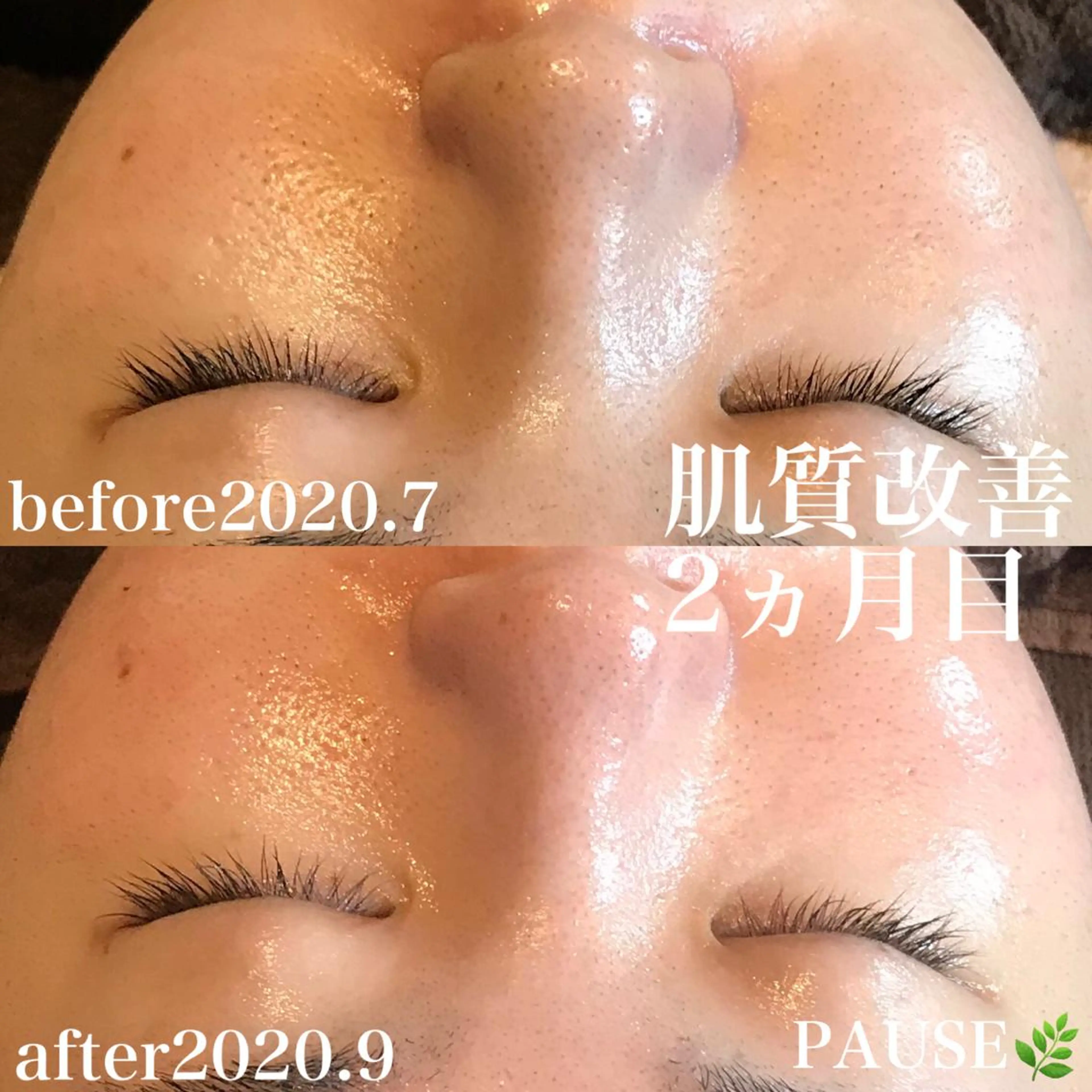 エステ 浜野 恵美のエステ・リラクイメージ