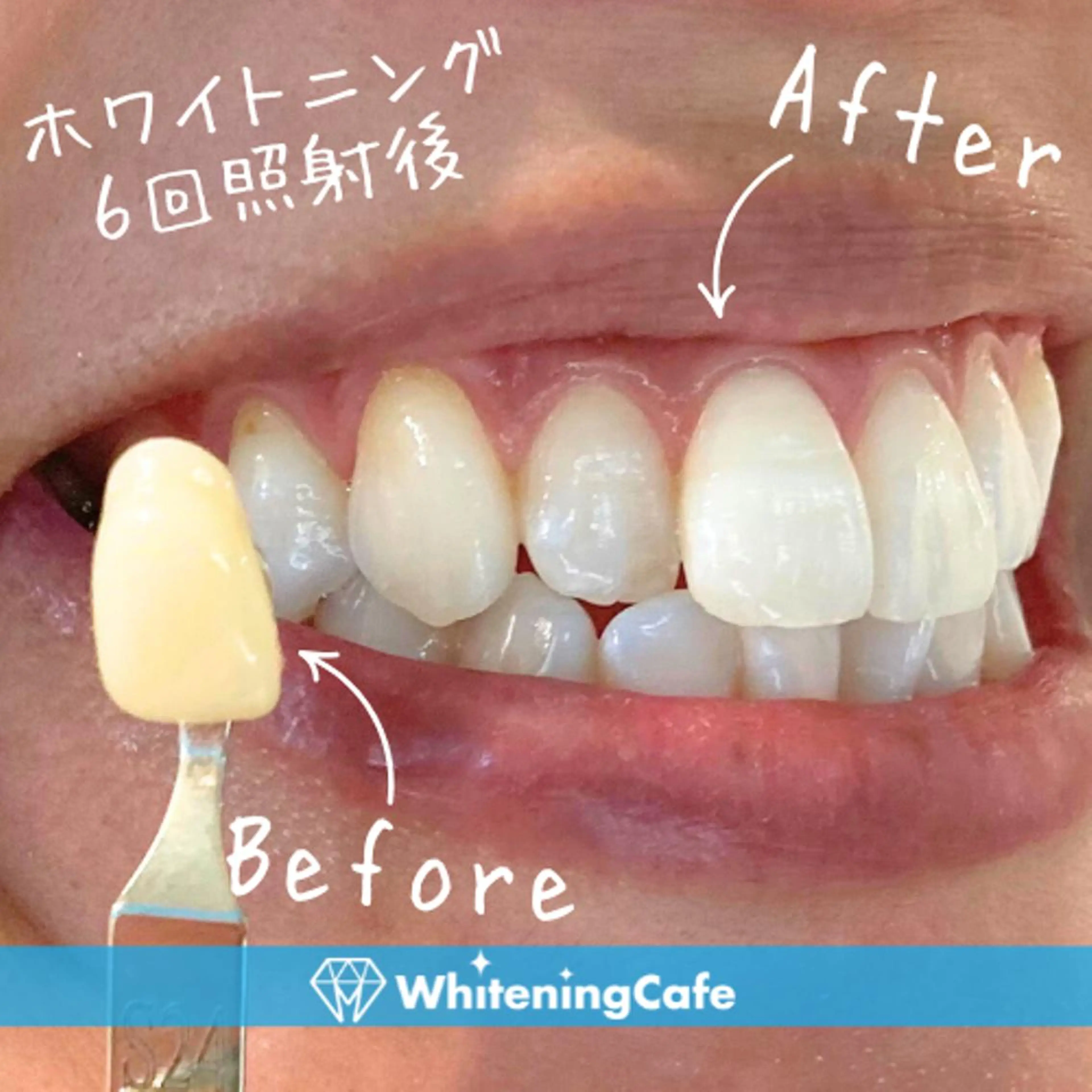 メンズ エステ リラク ホワイトニング カフェ志木店のエステ・リラクイメージ