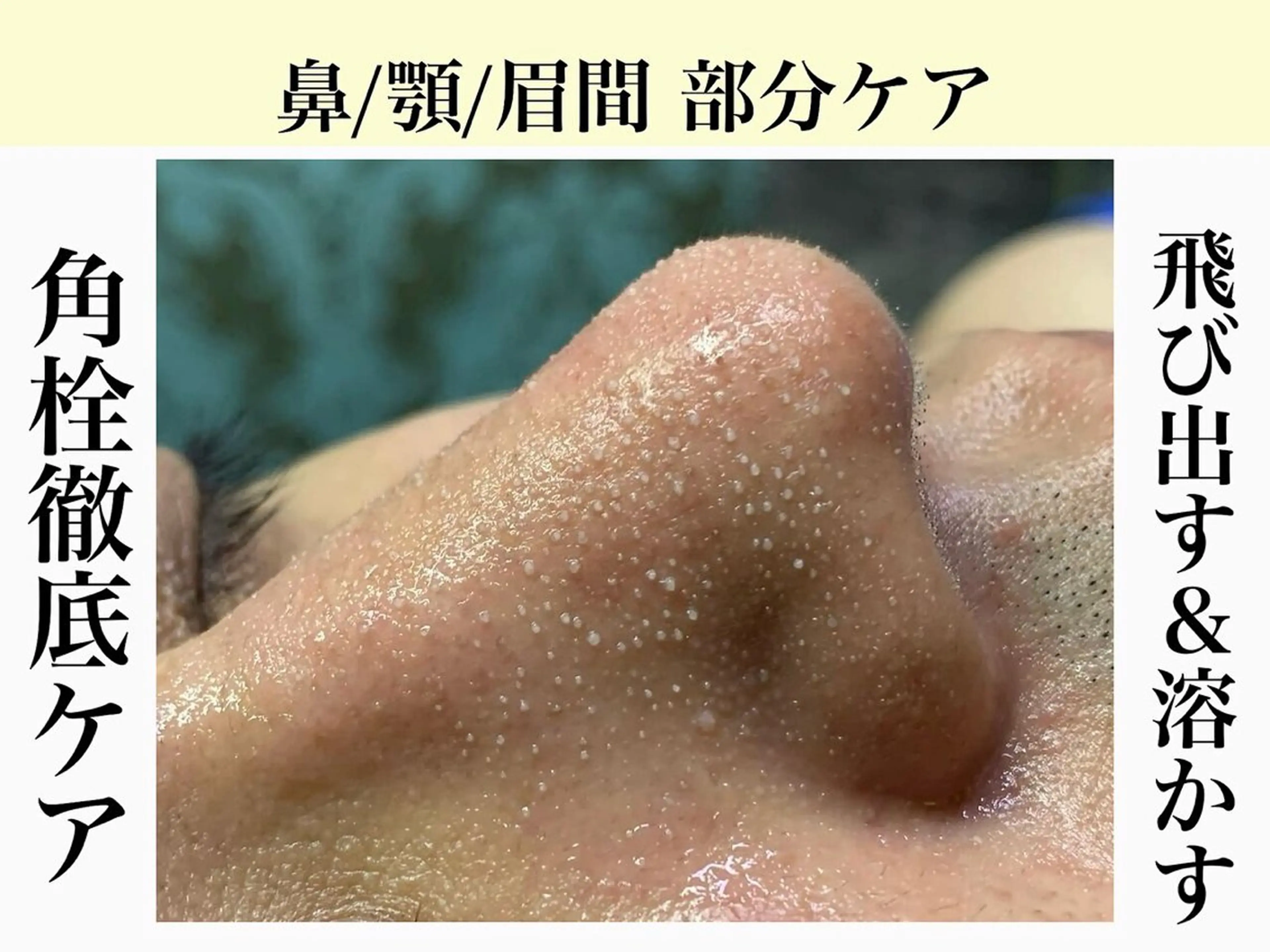 フェイシャル/脱毛 ジョアアンジェ小夷のエステ・リラクイメージ