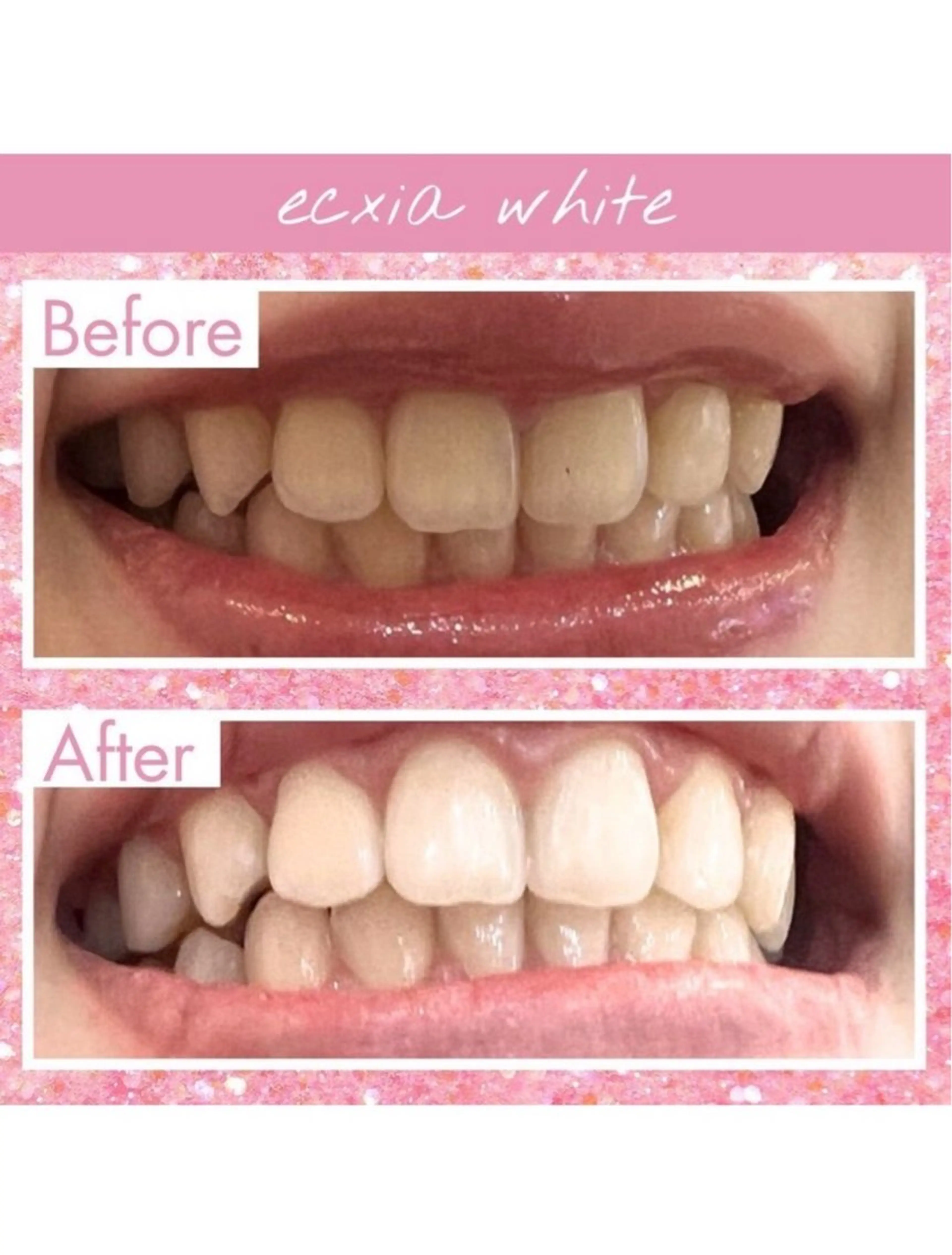 セルフホワイトニング エクシア武蔵小杉店のその他イメージ