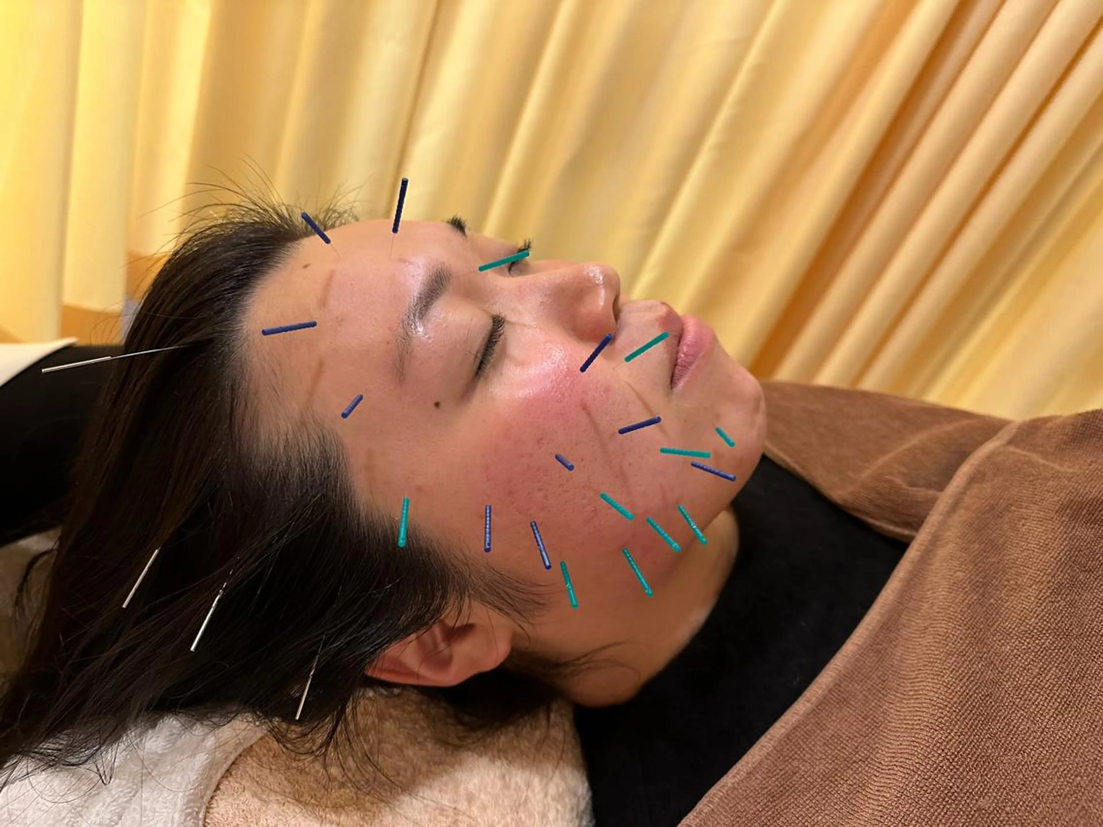 その他 鍼灸サロン BBB3のその他イメージ