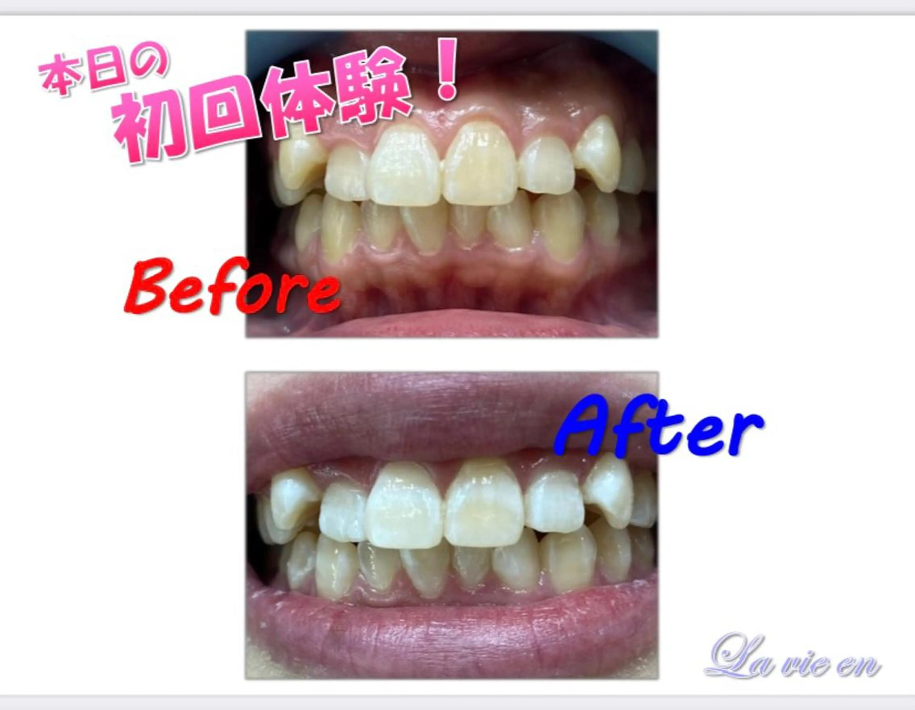 その他 ホワイトニングサロン La vie enのその他イメージ