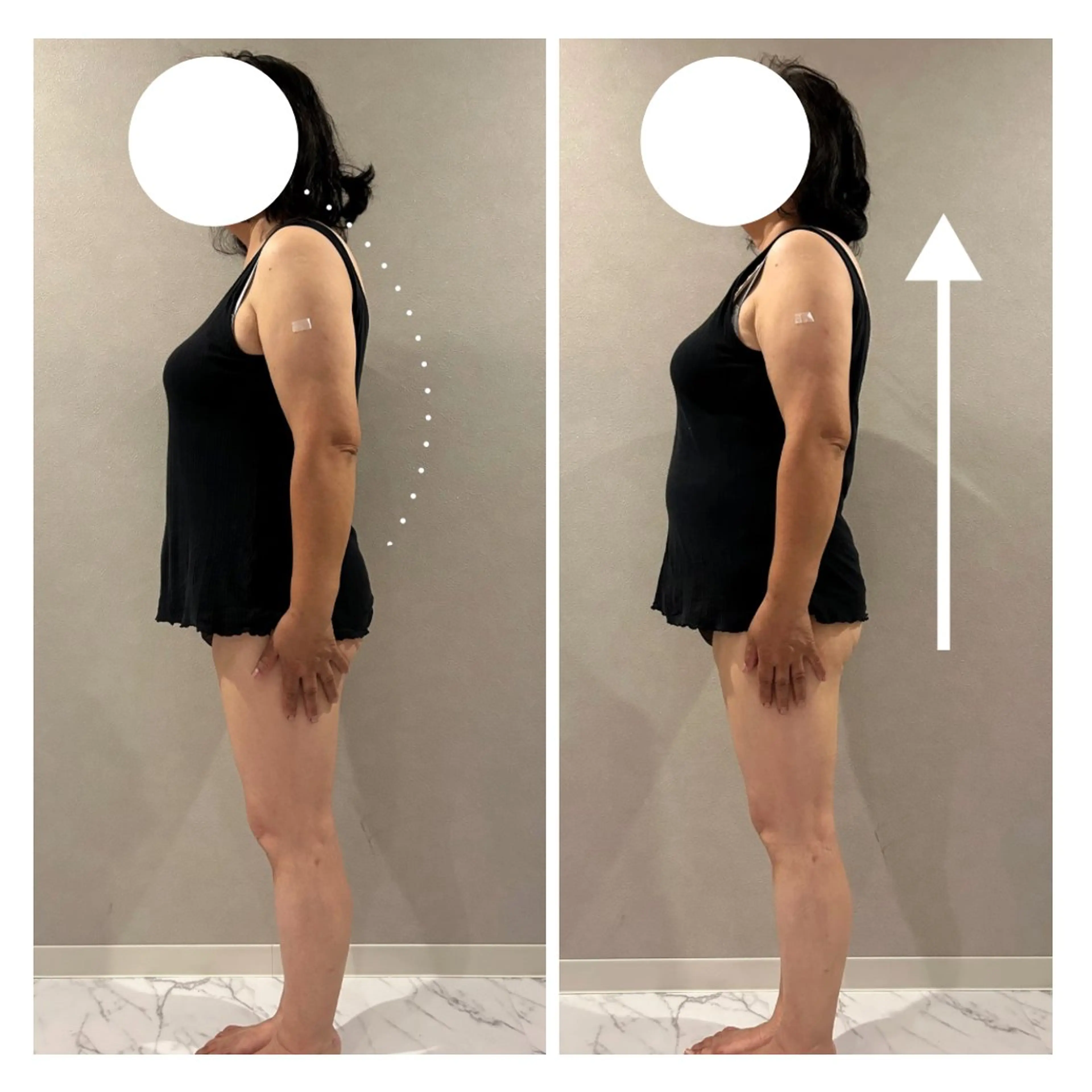 【猫背・反り腰の方に】姿勢分析＋整う体感30分🌿バスト＆くびれも美しく✨の写真