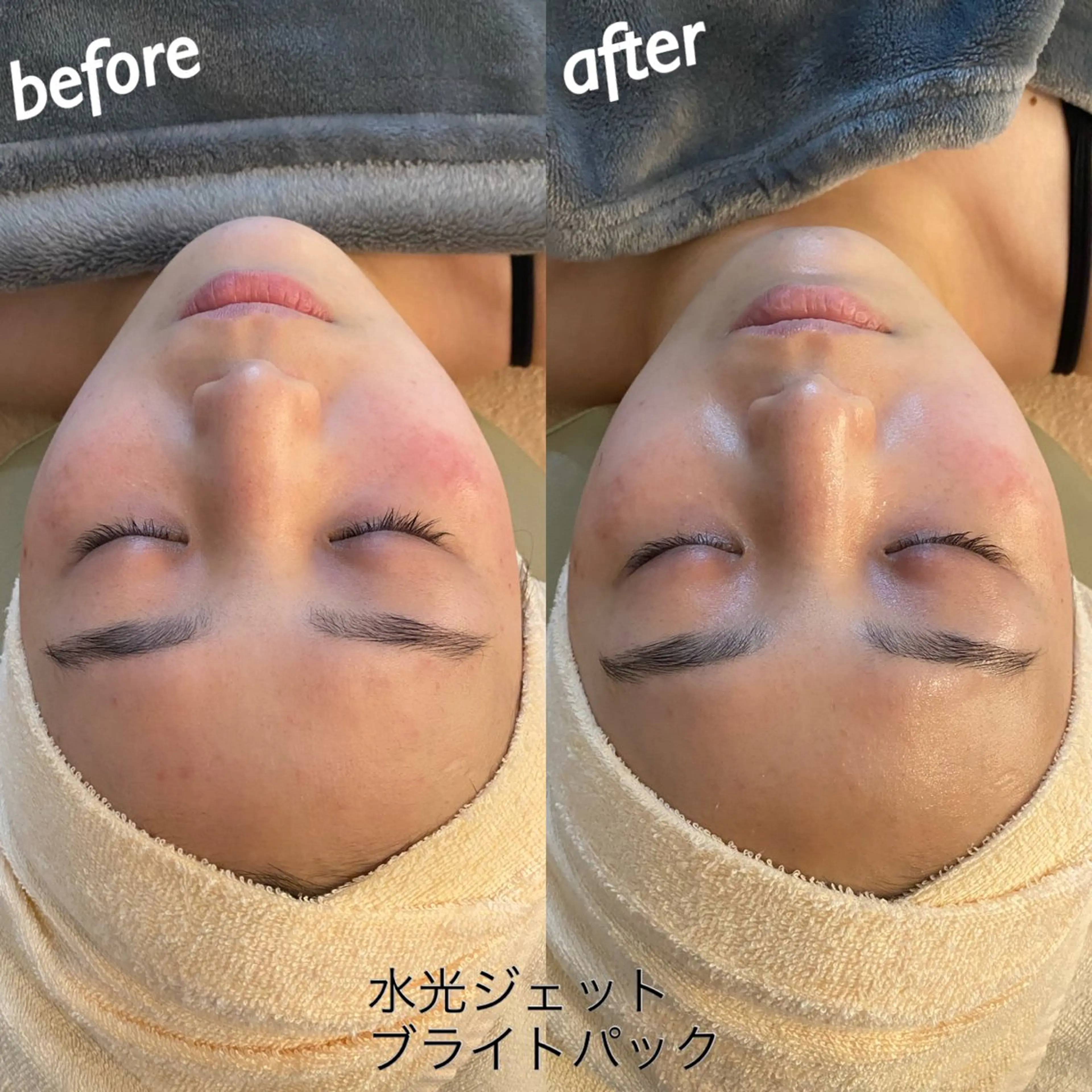 うなじ脱毛/美肌脱毛 LABELのエステ・リラクイメージ