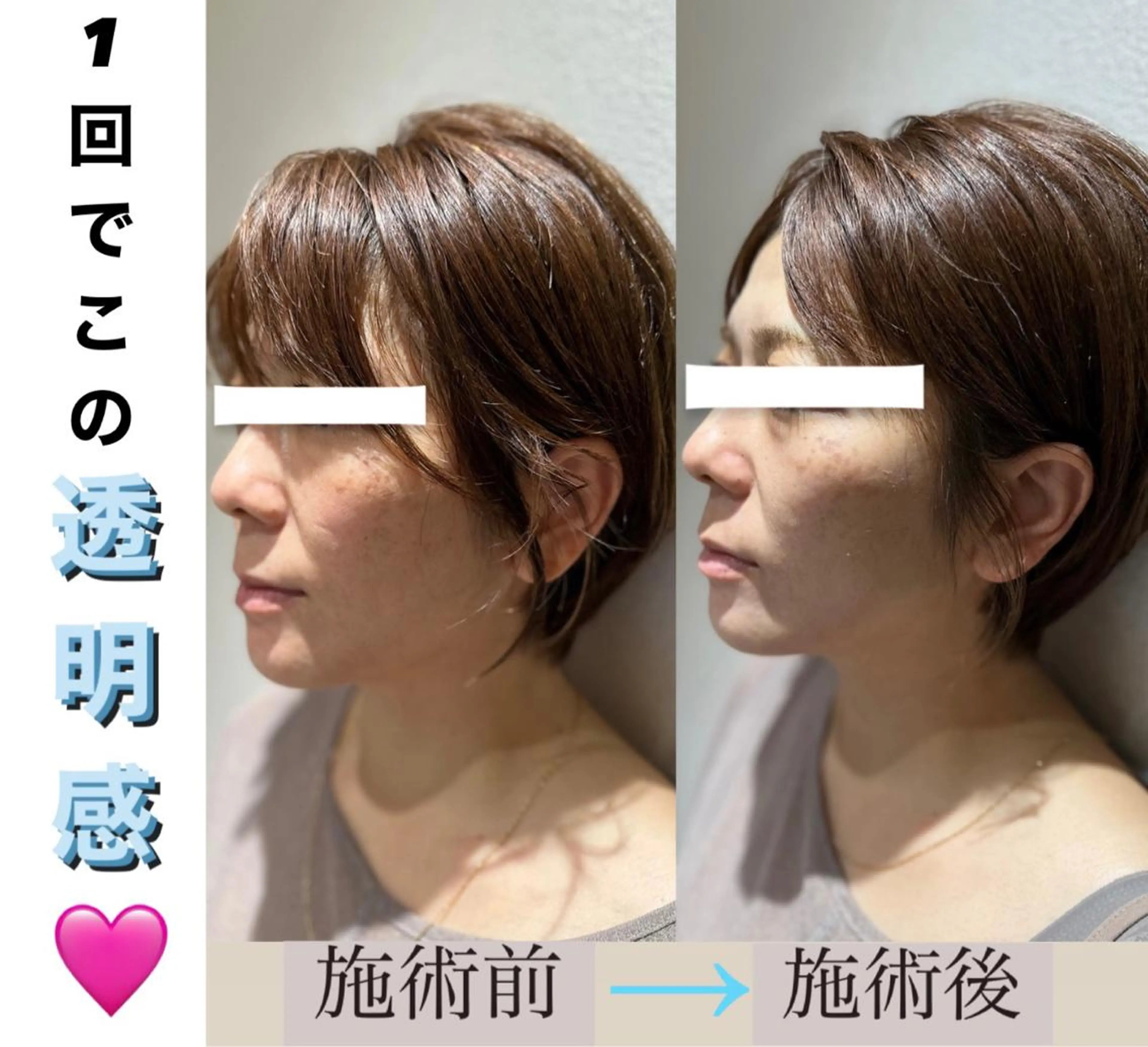 脱毛&美容サロン BLUESEAのエステ・リラクイメージ