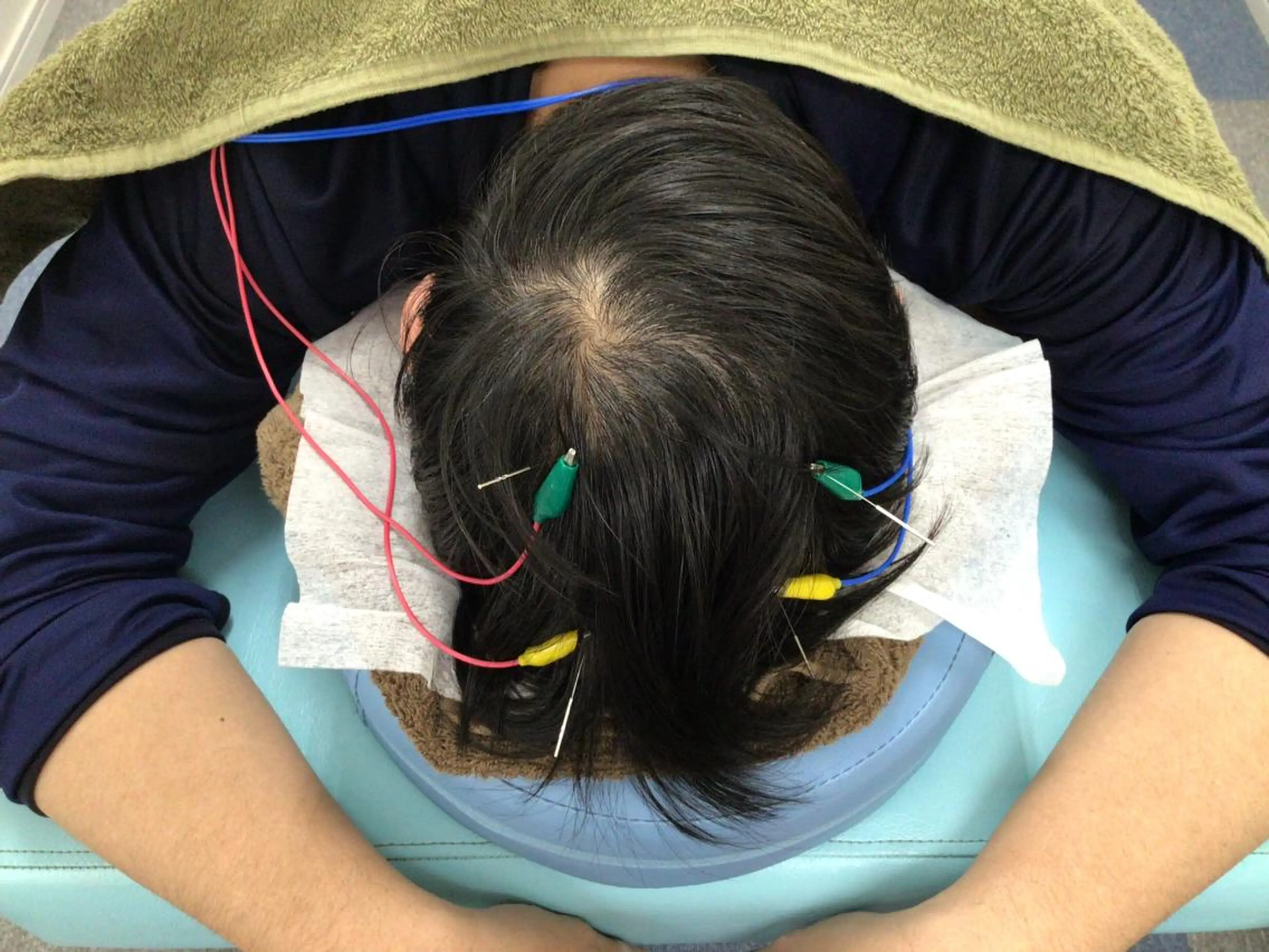 サポート鍼灸整骨院所属・サポート 鍼灸整骨院のエステ・リラクイメージ