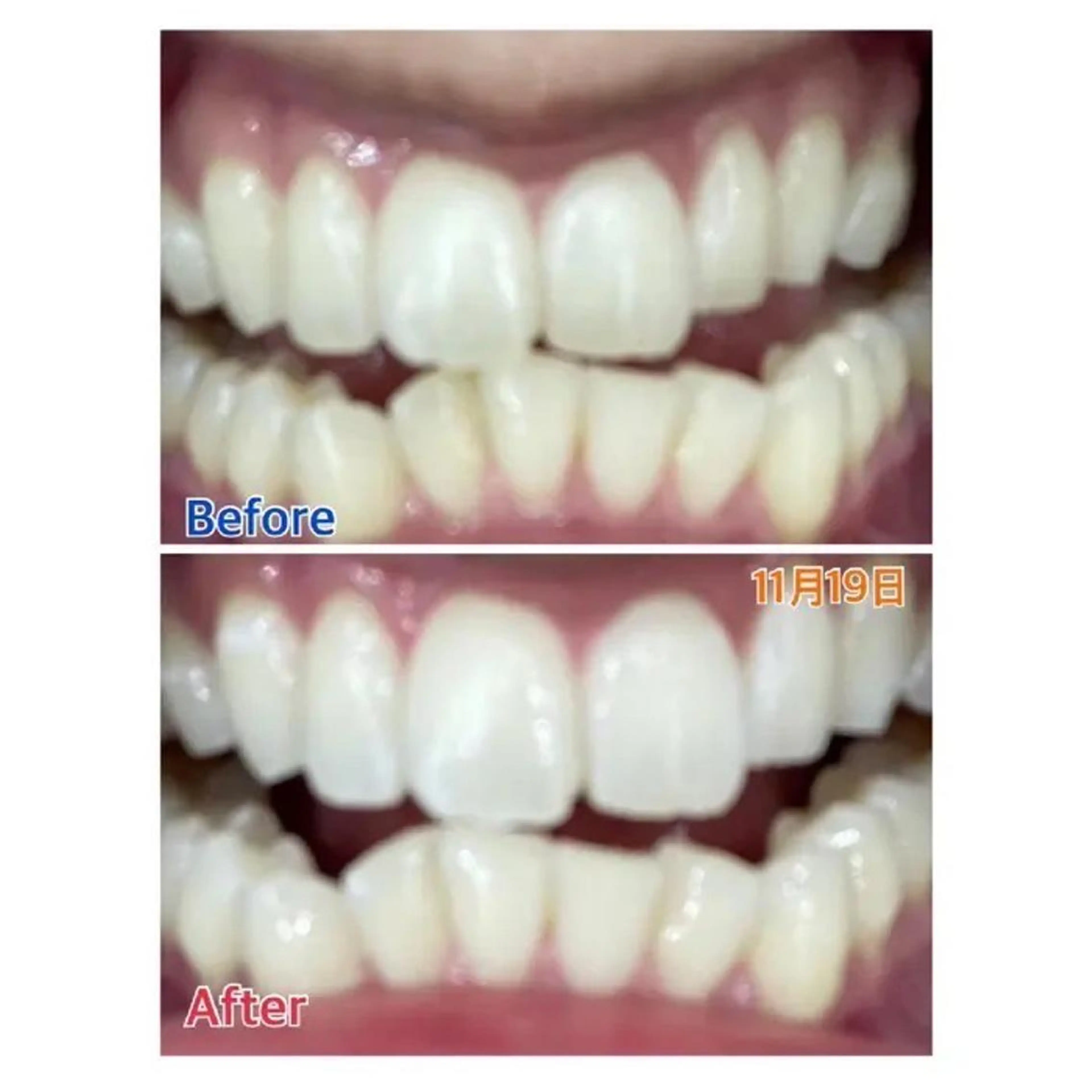 M渋谷 ホワイトニングのその他イメージ