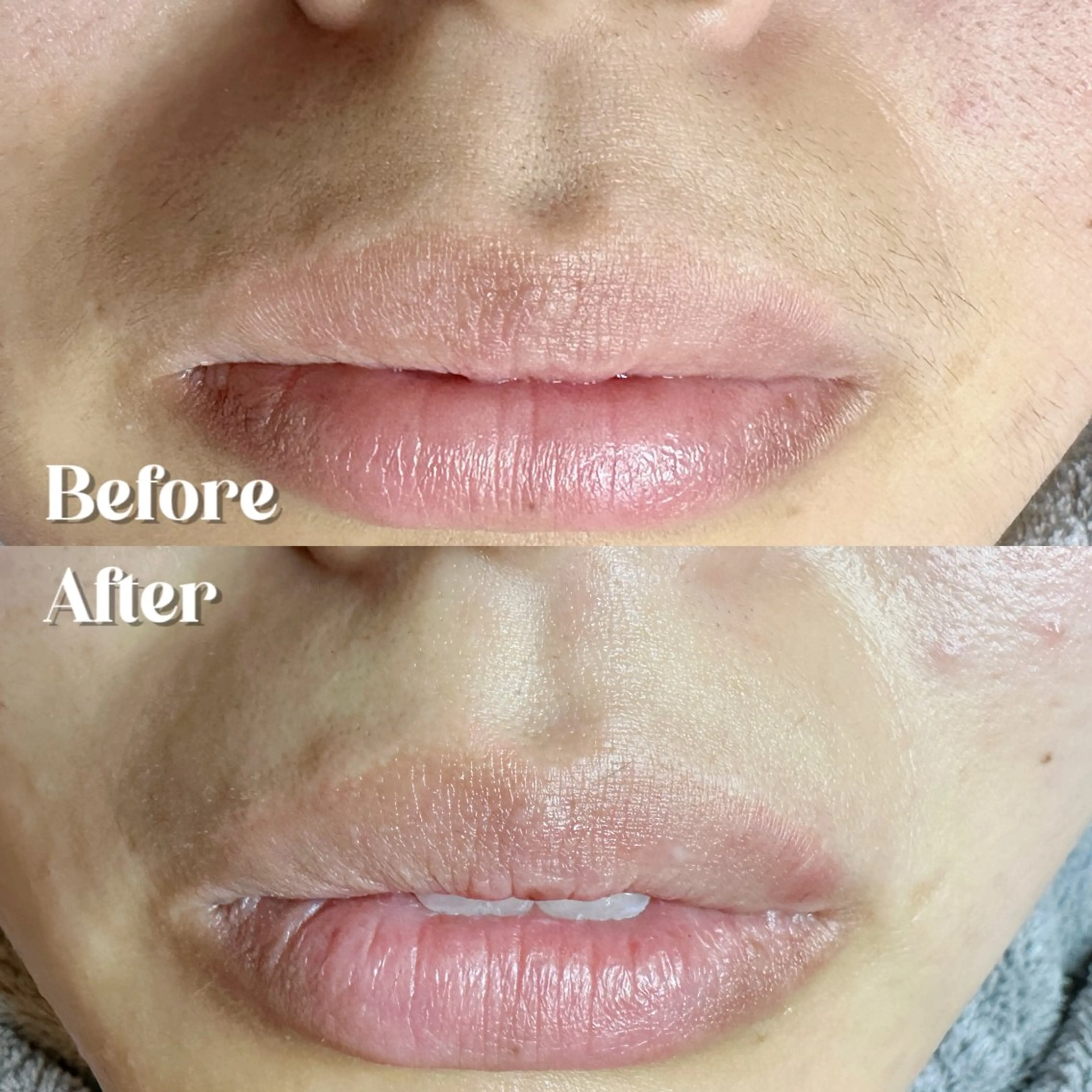 Hitomi シュガーリング豊橋のその他イメージ