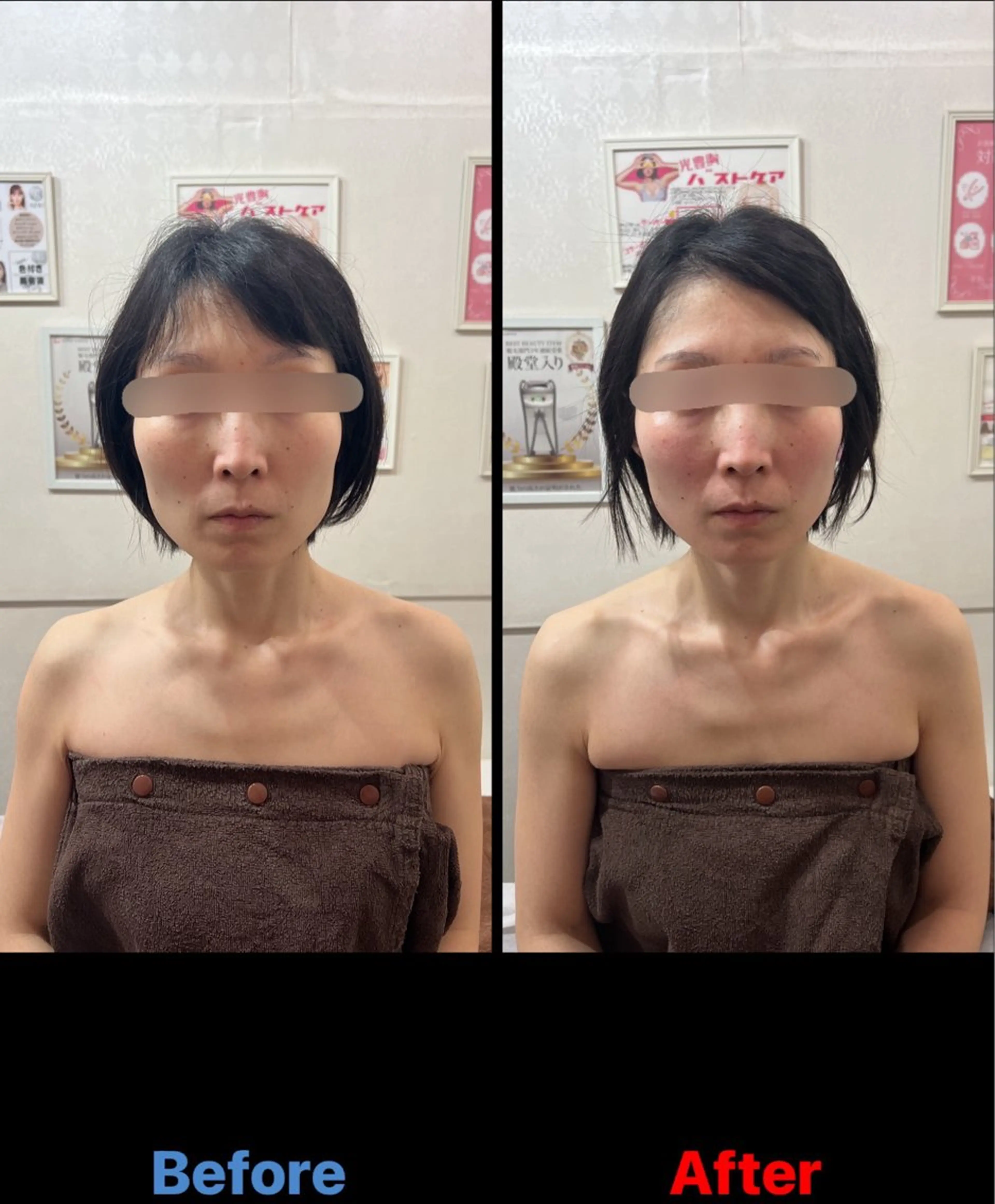 毛穴改善/脱毛 ネイル　川上久仁子のエステ・リラクイメージ