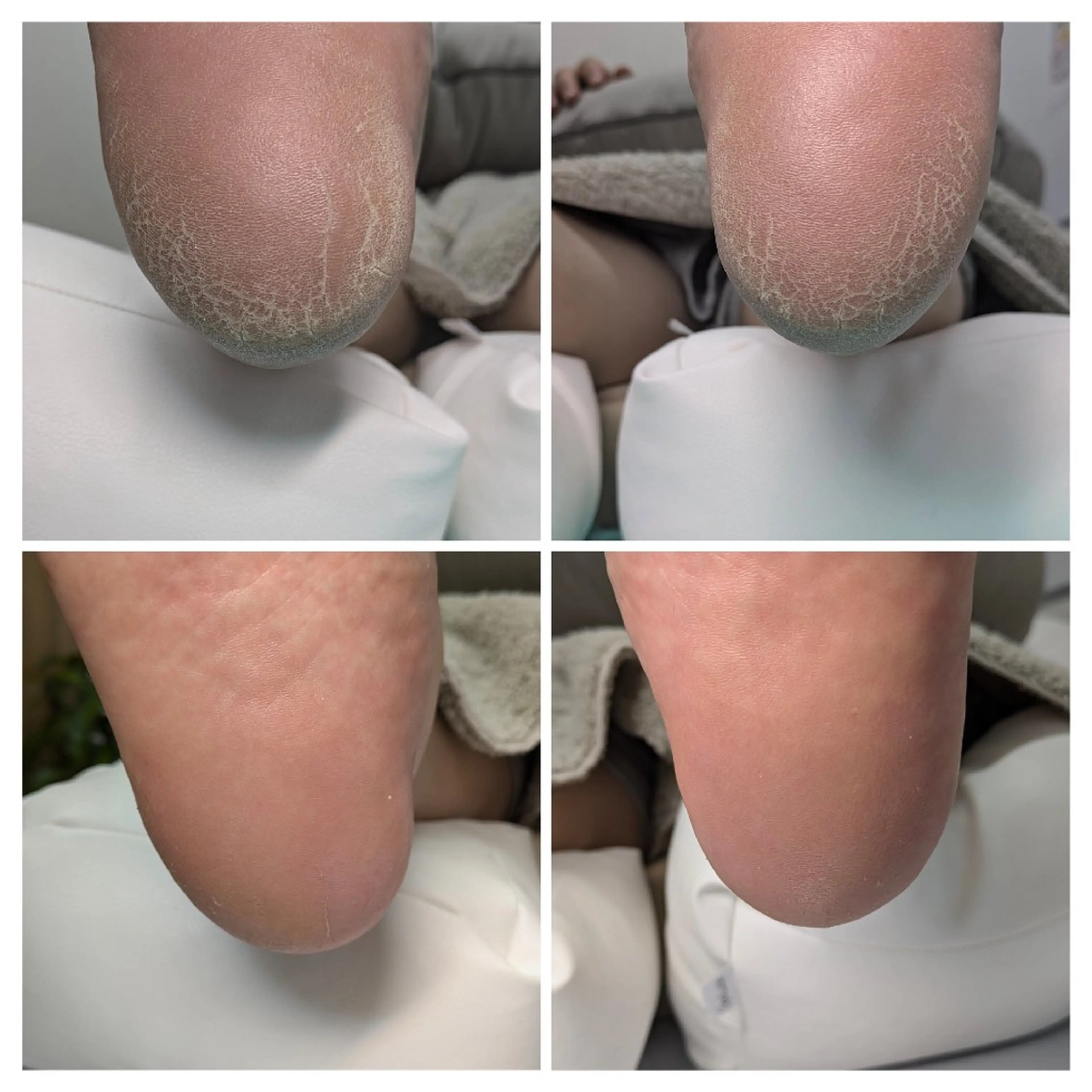 巻き爪補正店 大阪なんば店のネイルデザイン