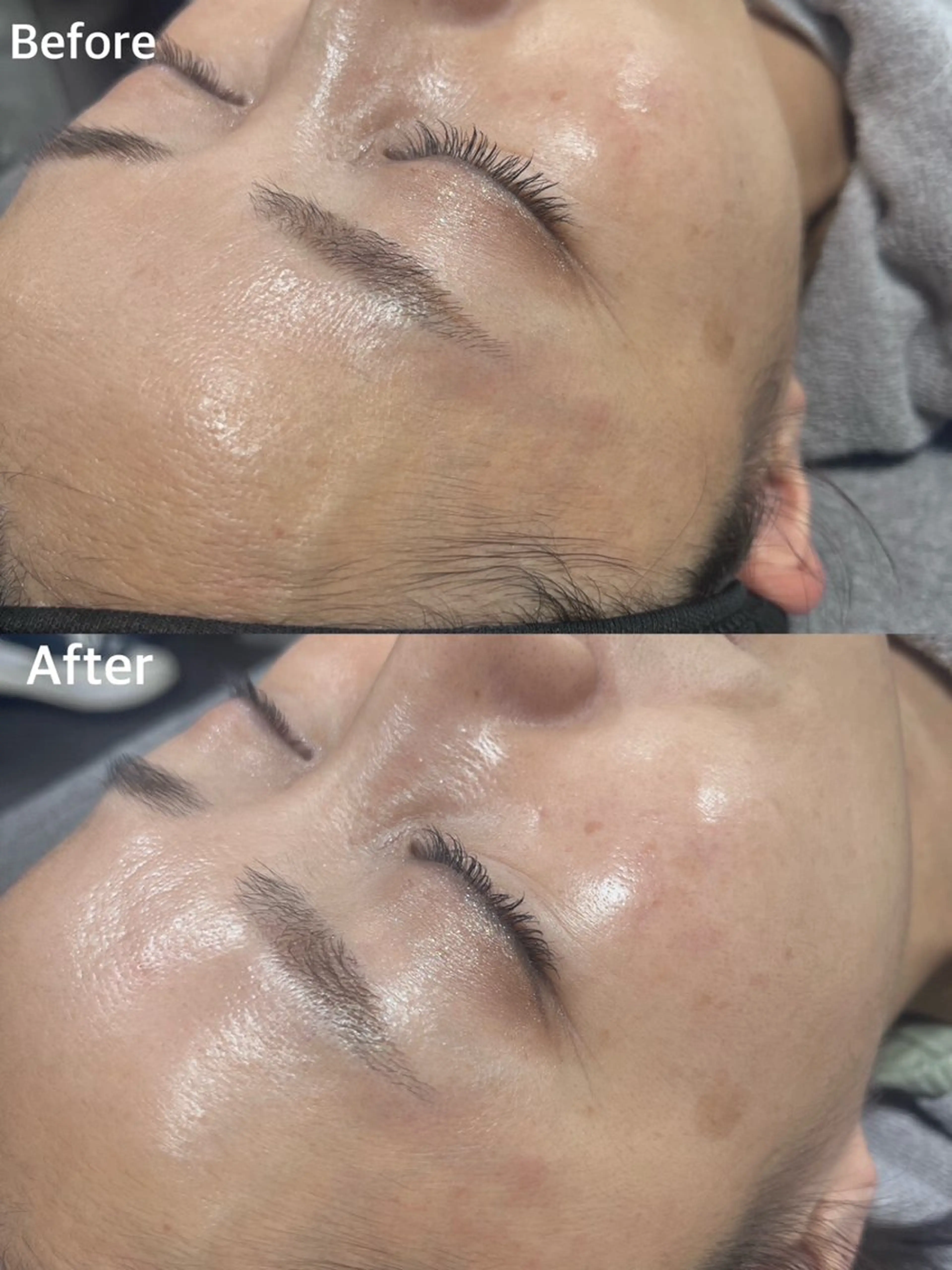 韓国式肌管理 ララピール専門のエステ・リラクイメージ