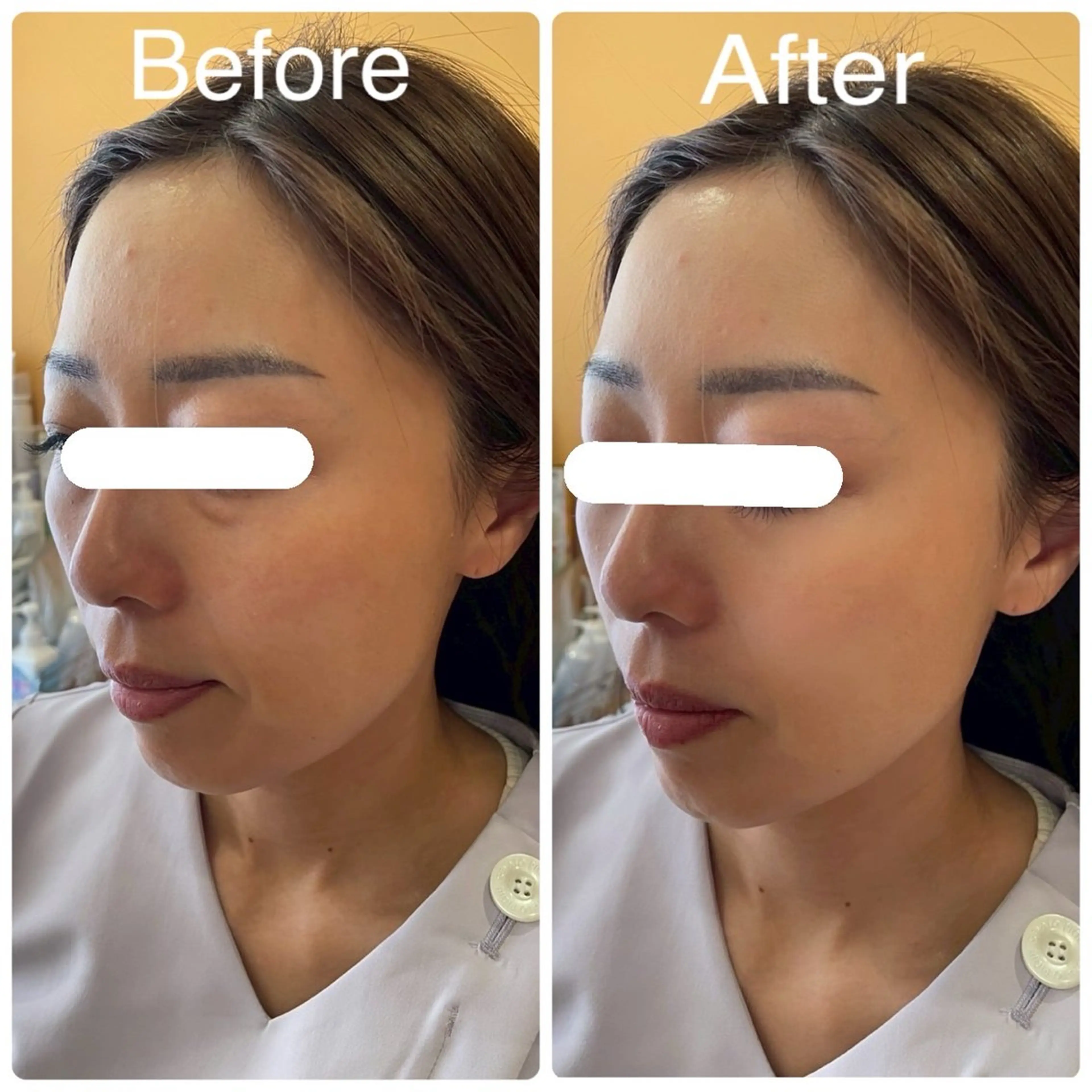 エステ 毛穴＆ホワイトニング mielのエステ・リラクイメージ